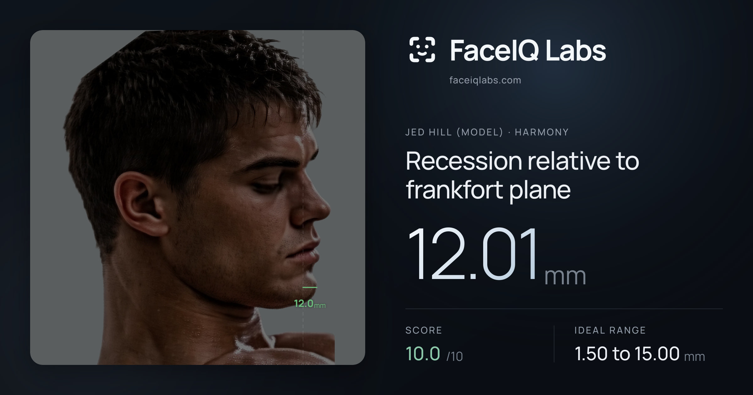 Jed Hill (Model) Recession relative to frankfort plane: 12.01mm, drawn on the photo