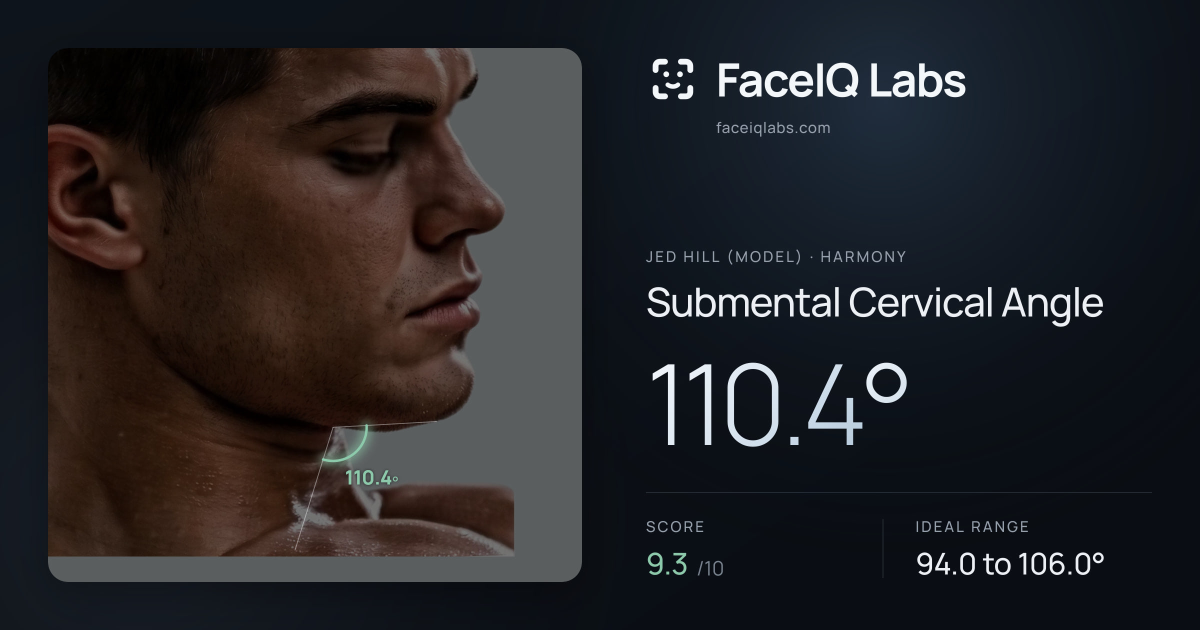 Jed Hill (Model) Submental Cervical Angle: 110.4°, drawn on the photo