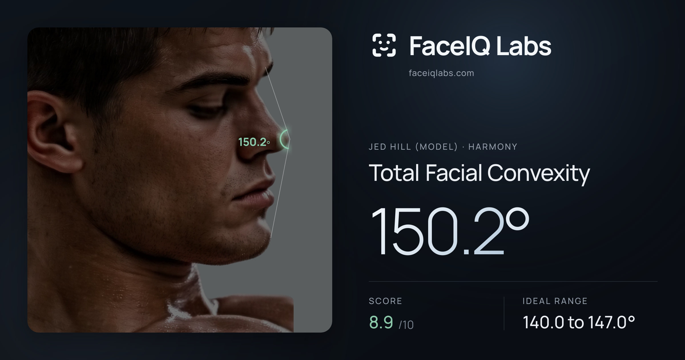 Jed Hill (Model) Total Facial Convexity: 150.2°, drawn on the photo