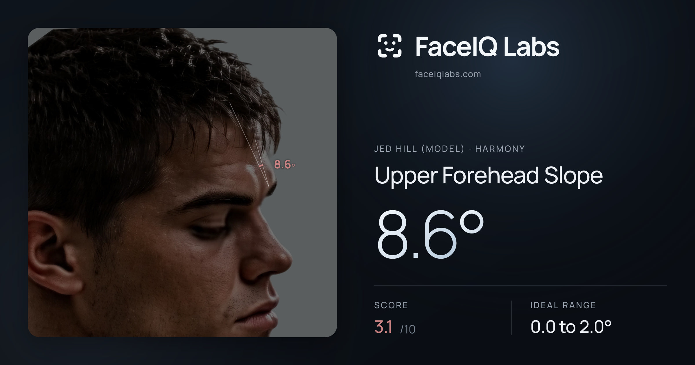 Jed Hill (Model) Upper Forehead Slope: 8.6°, drawn on the photo
