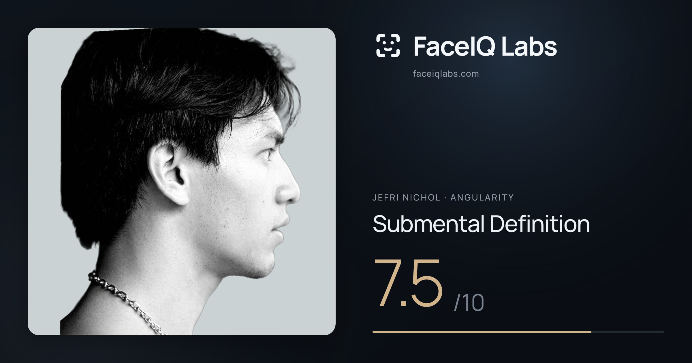 Jefri Nichol Submental Definition: 7.5/10, drawn on the photo