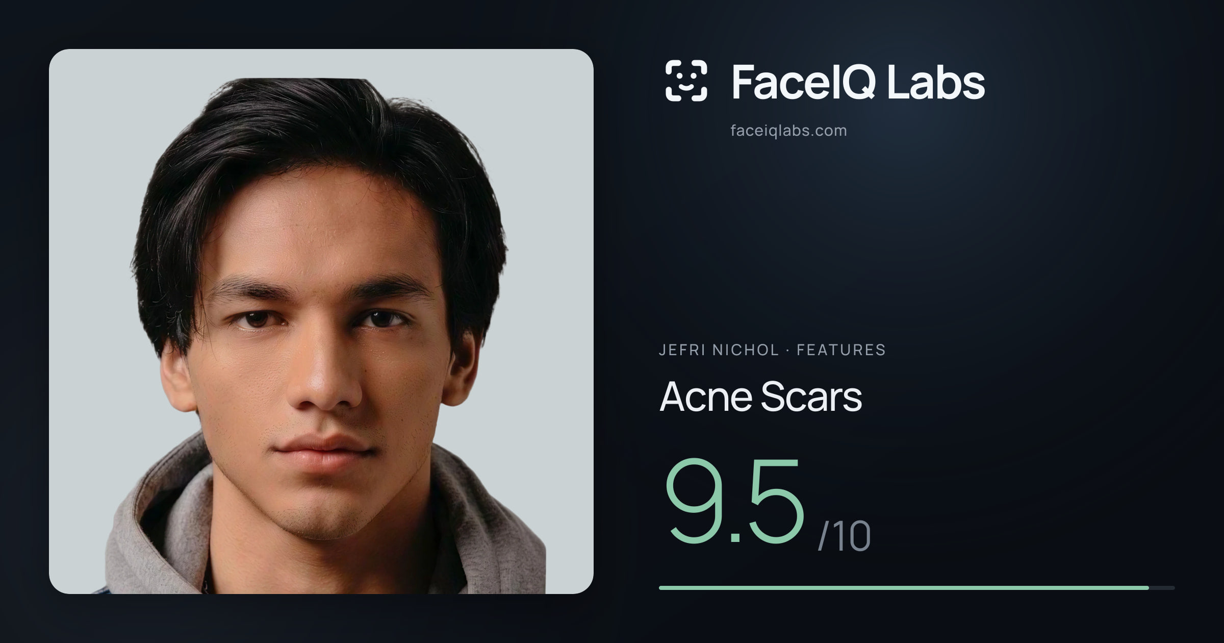 Jefri Nichol Acne Scars: 9.5/10, drawn on the photo