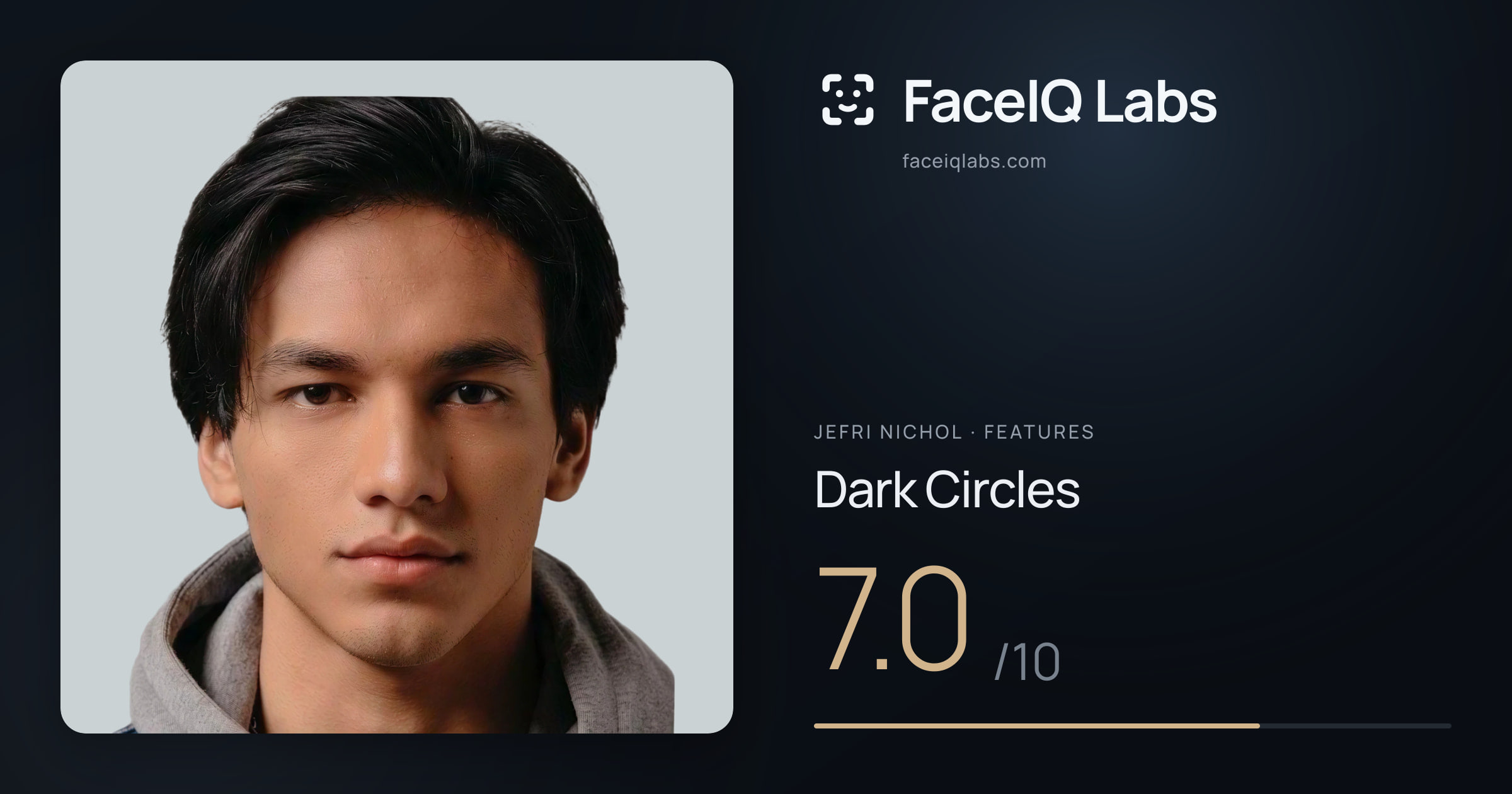 Jefri Nichol Dark Circles: 7.0/10, drawn on the photo