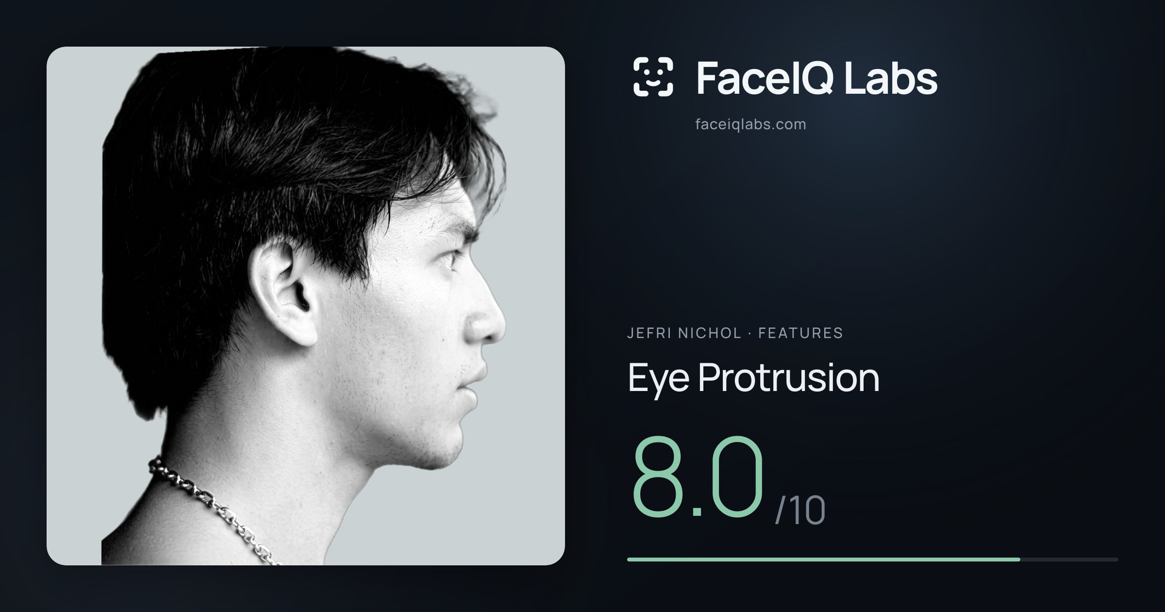 Jefri Nichol Eye Protrusion: 8.0/10, drawn on the photo