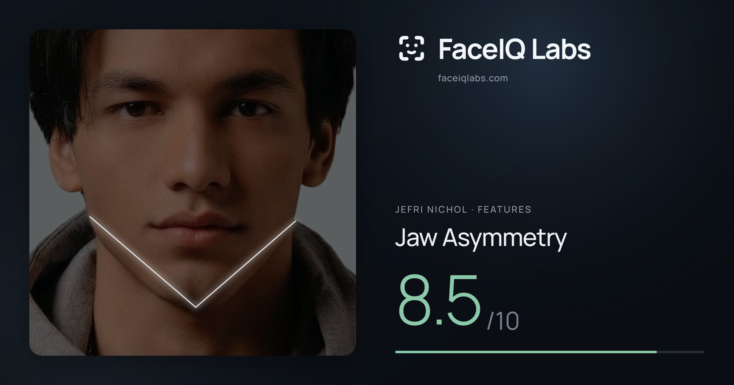 Jefri Nichol Jaw Asymmetry: 8.5/10, drawn on the photo