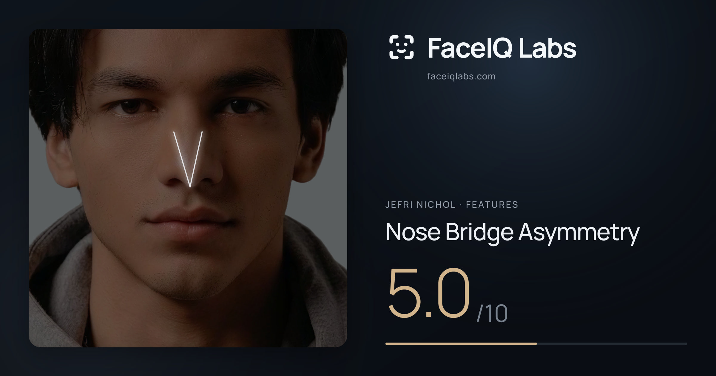 Jefri Nichol Nose Bridge Asymmetry: 5.0/10, drawn on the photo