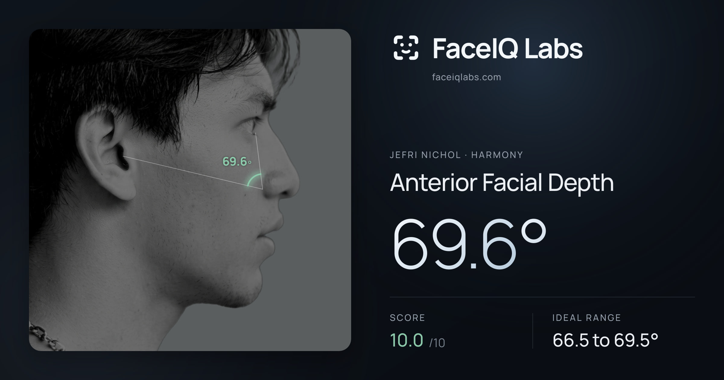 Jefri Nichol Anterior Facial Depth: 69.6°, drawn on the photo