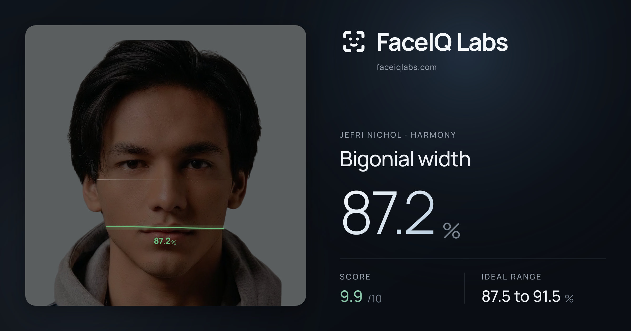 Jefri Nichol Bigonial width: 87.2%, drawn on the photo