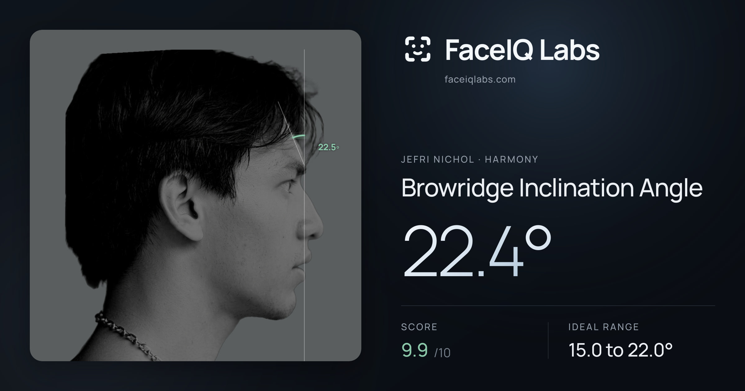 Jefri Nichol Browridge Inclination Angle: 22.4°, drawn on the photo