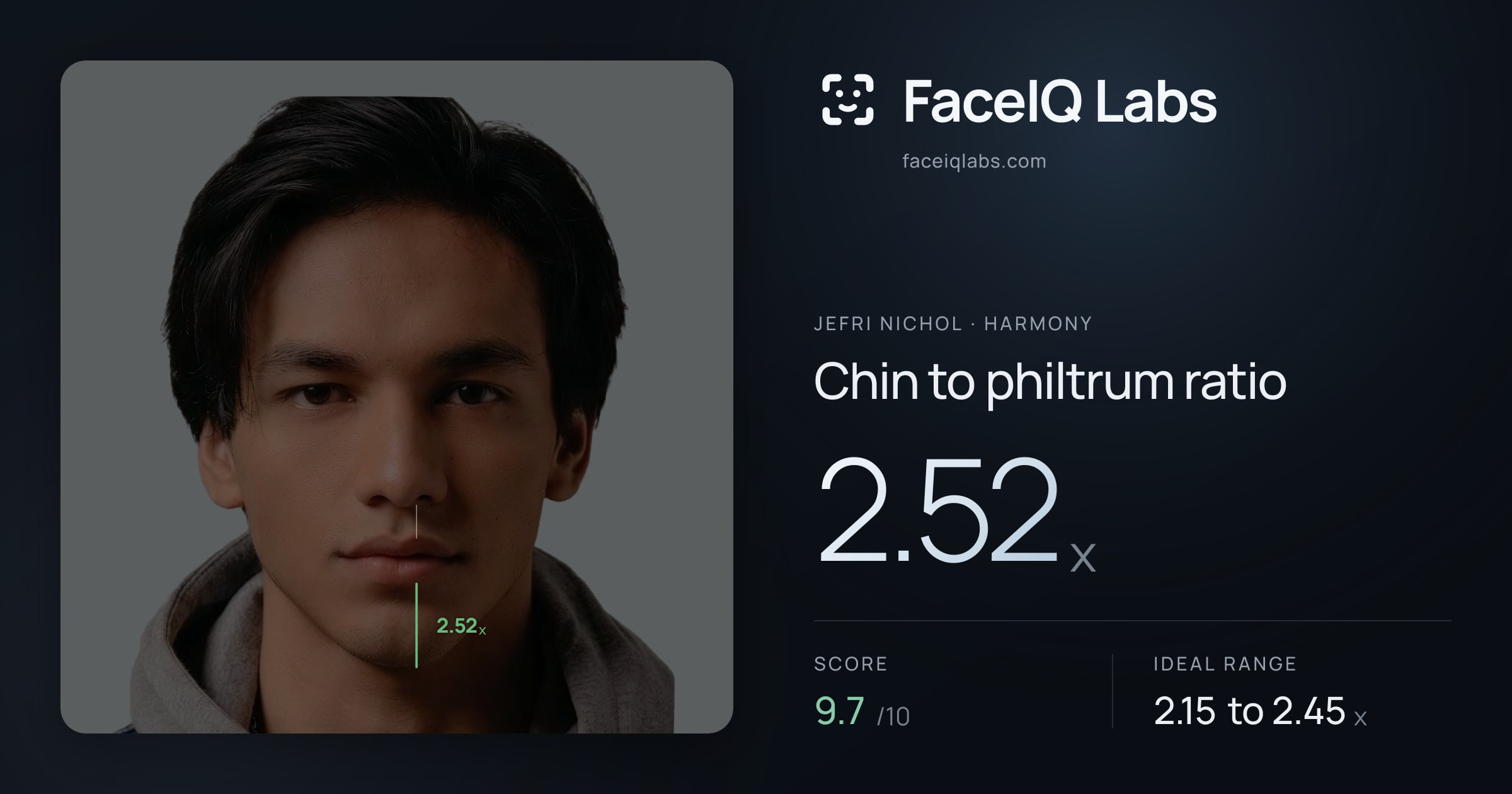 Jefri Nichol Chin to philtrum ratio: 2.52x, drawn on the photo