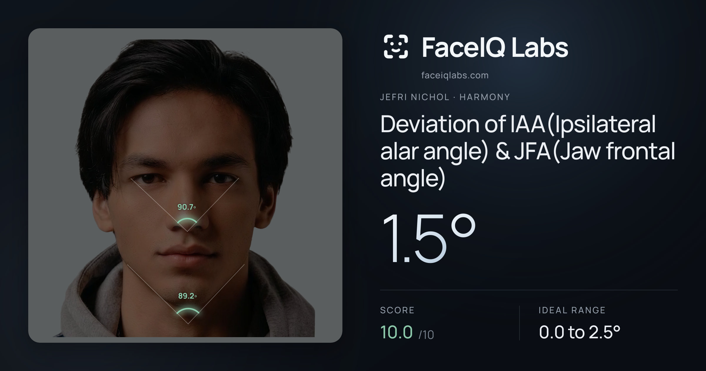 Jefri Nichol Deviation of IAA(Ipsilateral alar angle) & JFA(Jaw frontal angle): 1.5°, drawn on the photo