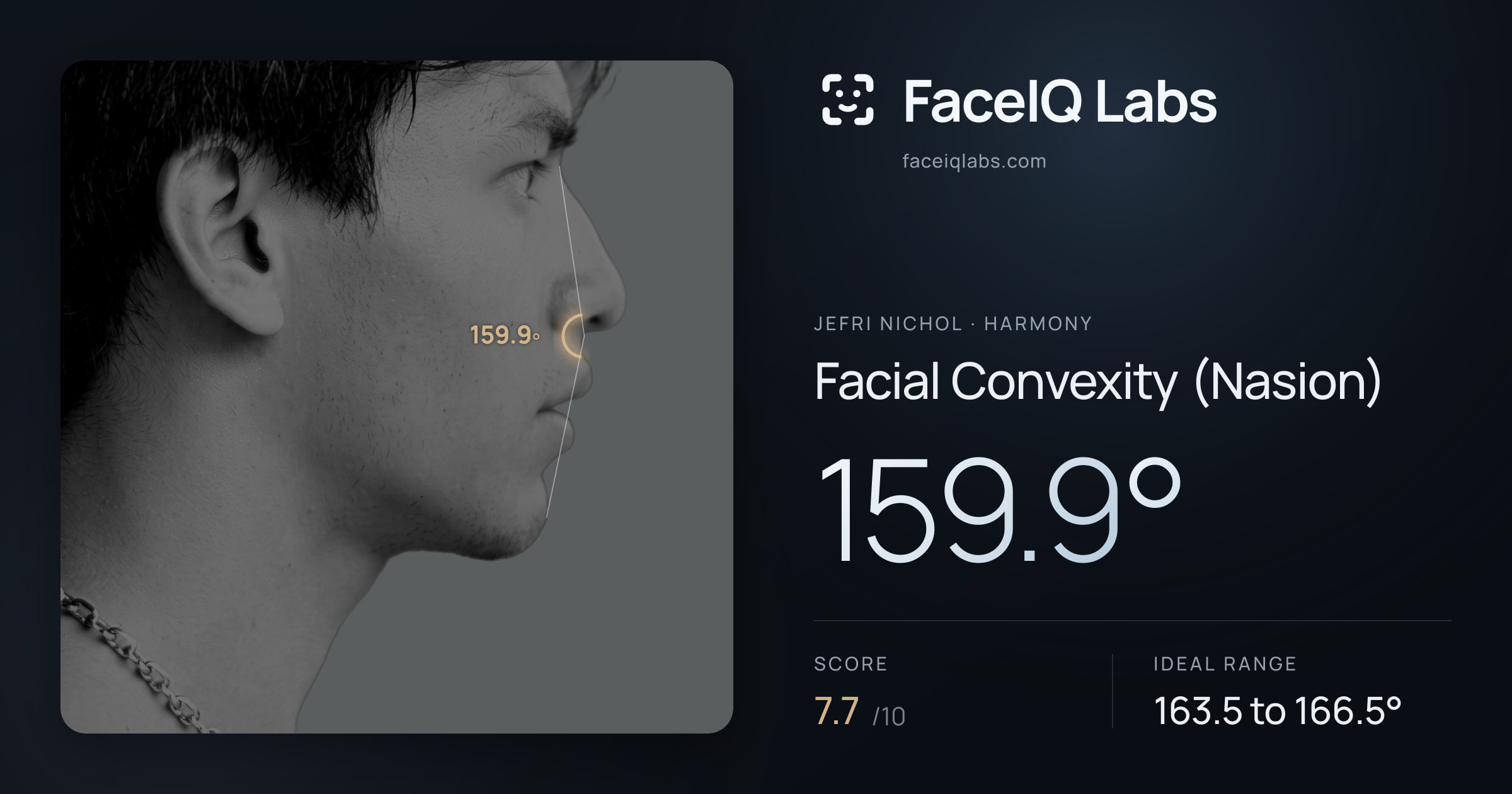 Jefri Nichol Facial Convexity (Nasion): 159.9°, drawn on the photo