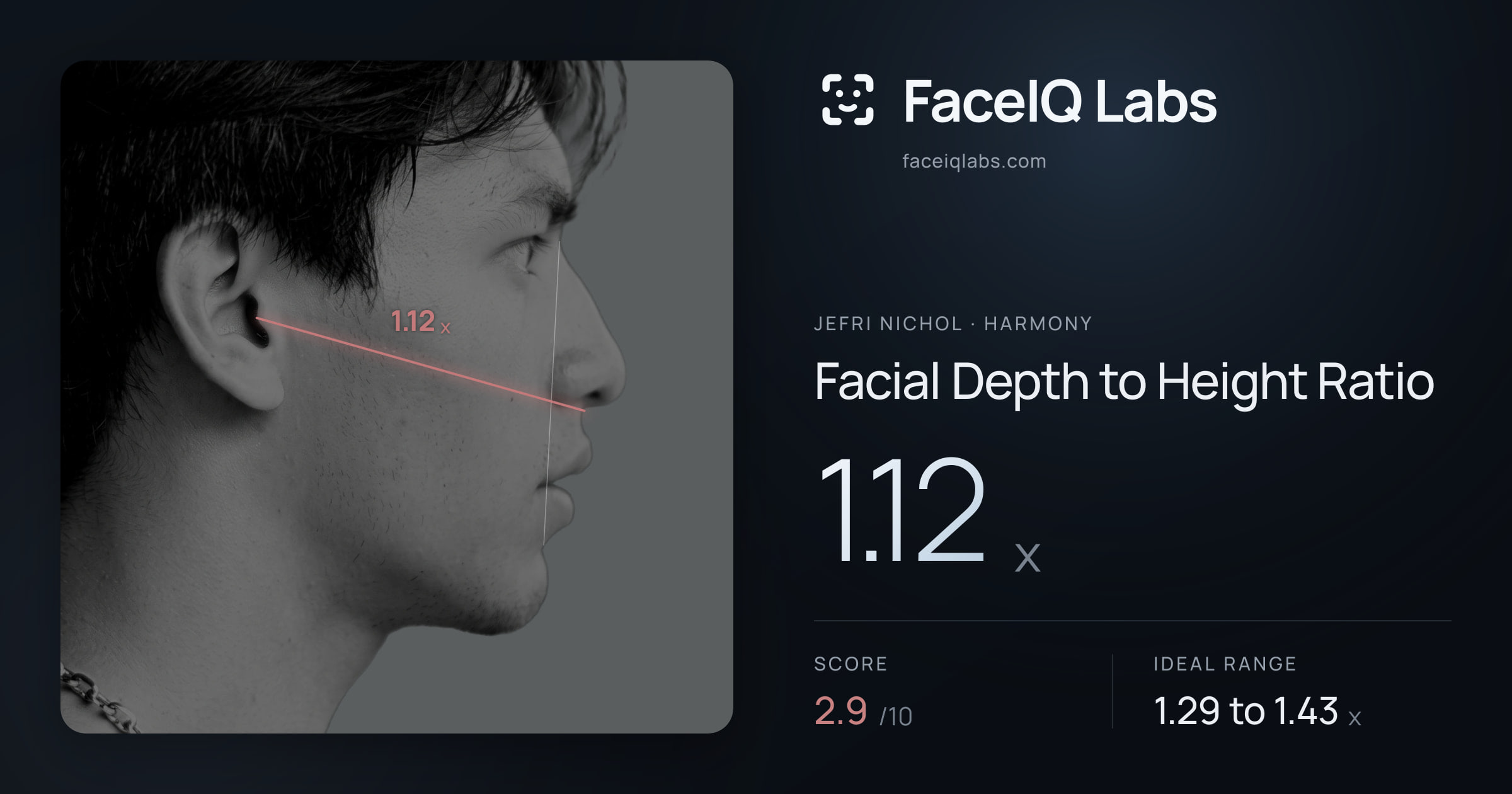 Jefri Nichol Facial Depth to Height Ratio: 1.12x, drawn on the photo