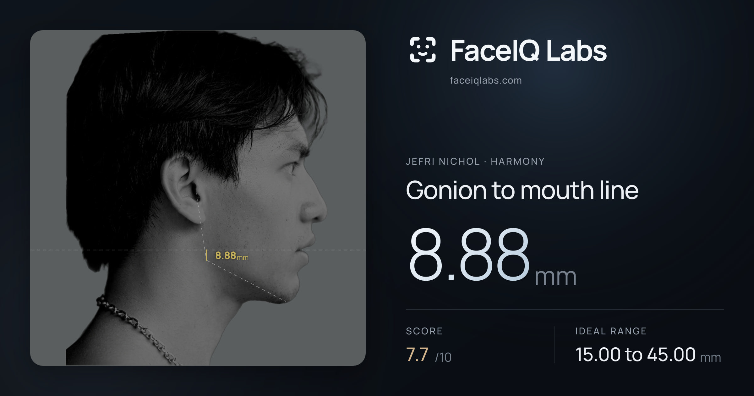 Jefri Nichol Gonion to mouth line: 8.88mm, drawn on the photo