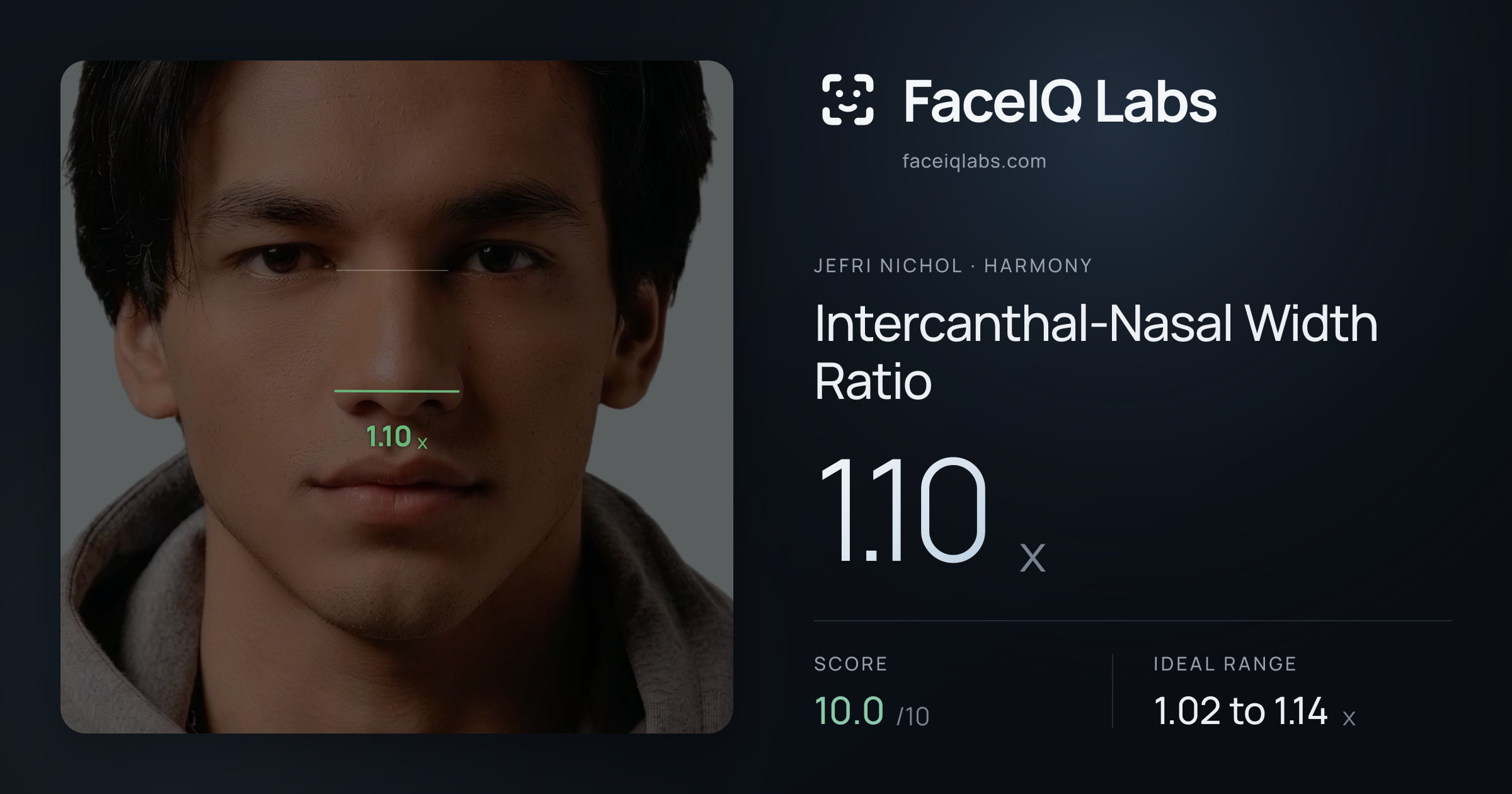 Jefri Nichol Intercanthal-Nasal Width Ratio: 1.10x, drawn on the photo