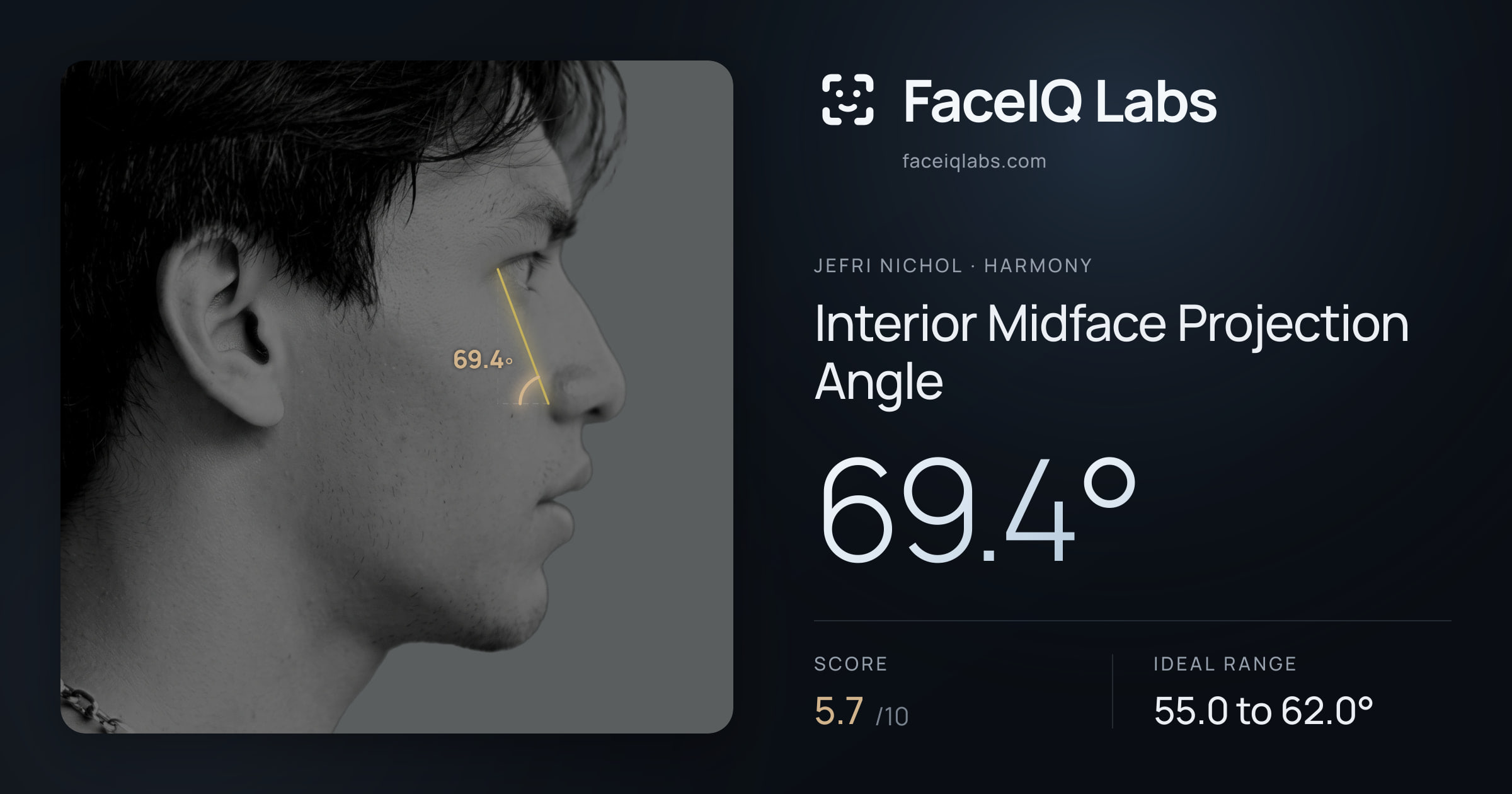 Jefri Nichol Interior Midface Projection Angle: 69.4°, drawn on the photo