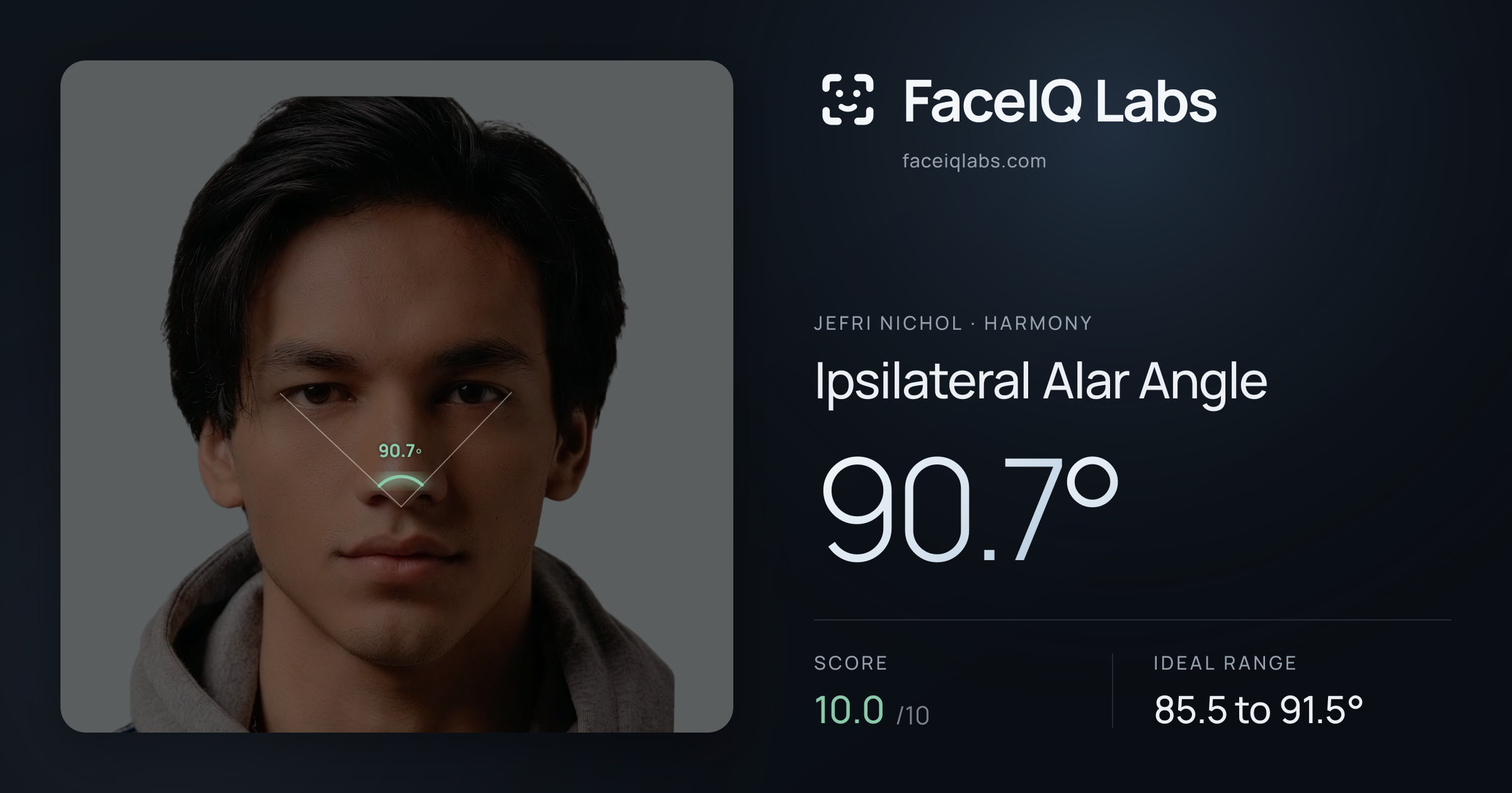Jefri Nichol Ipsilateral Alar Angle: 90.7°, drawn on the photo
