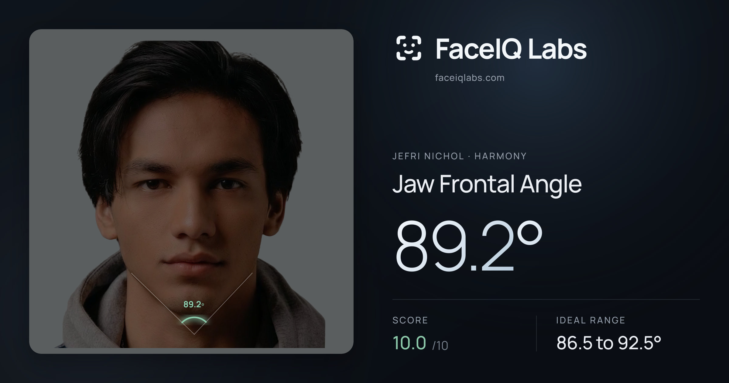 Jefri Nichol Jaw Frontal Angle: 89.2°, drawn on the photo