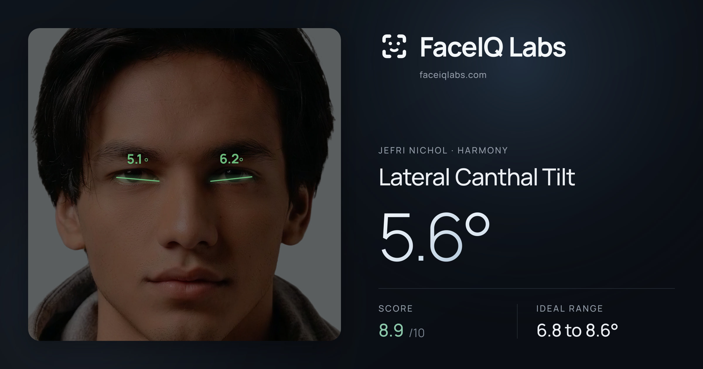 Jefri Nichol Lateral Canthal Tilt: 5.6°, drawn on the photo