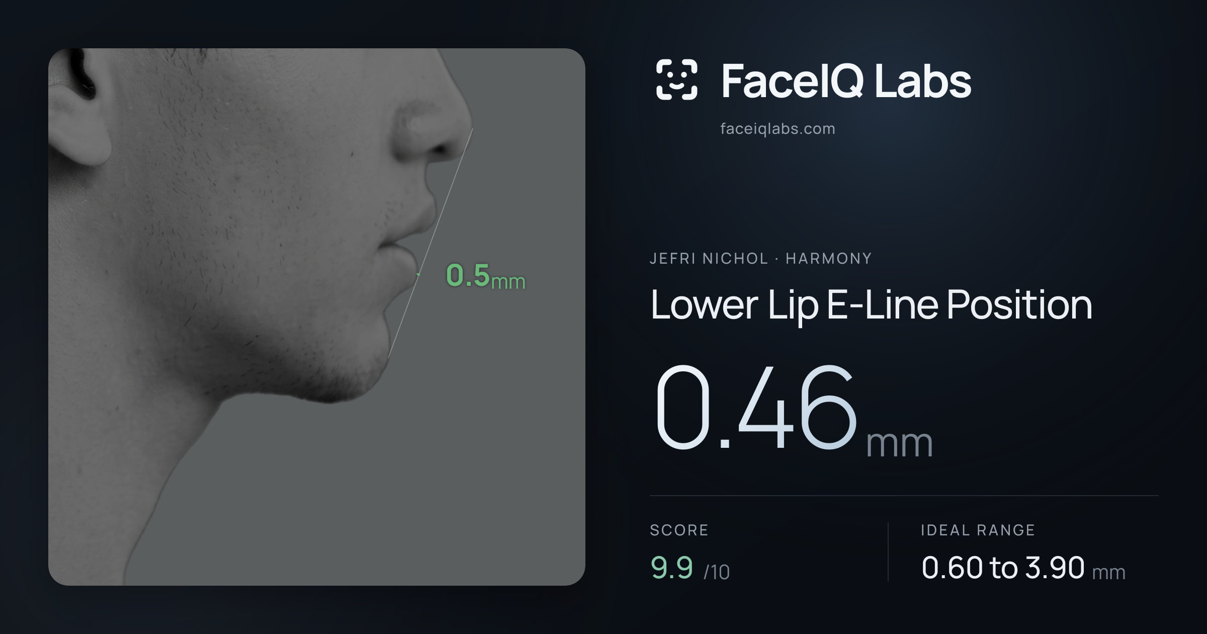 Jefri Nichol Lower Lip E-Line Position: 0.46mm, drawn on the photo