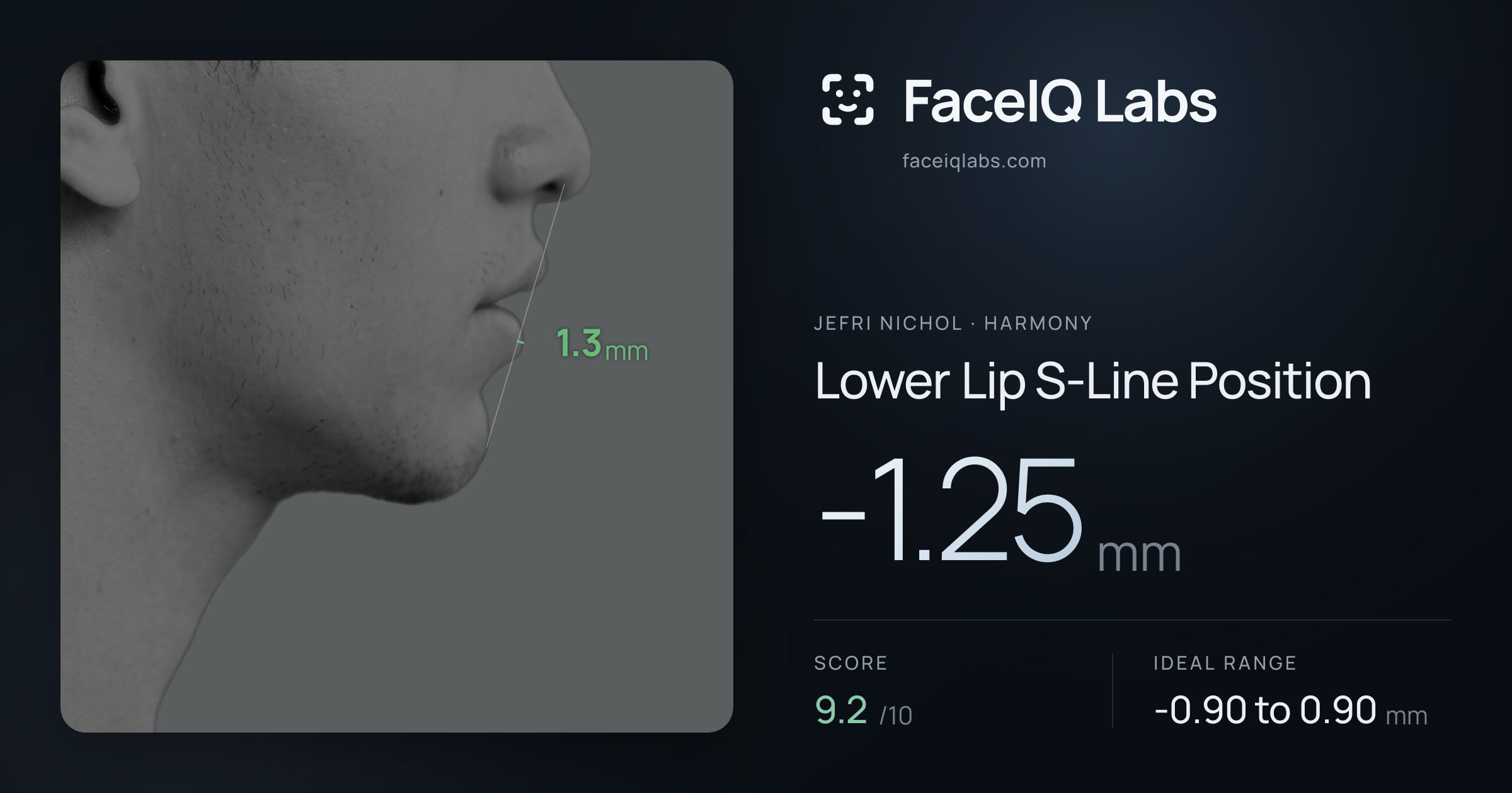 Jefri Nichol Lower Lip S-Line Position: -1.25mm, drawn on the photo