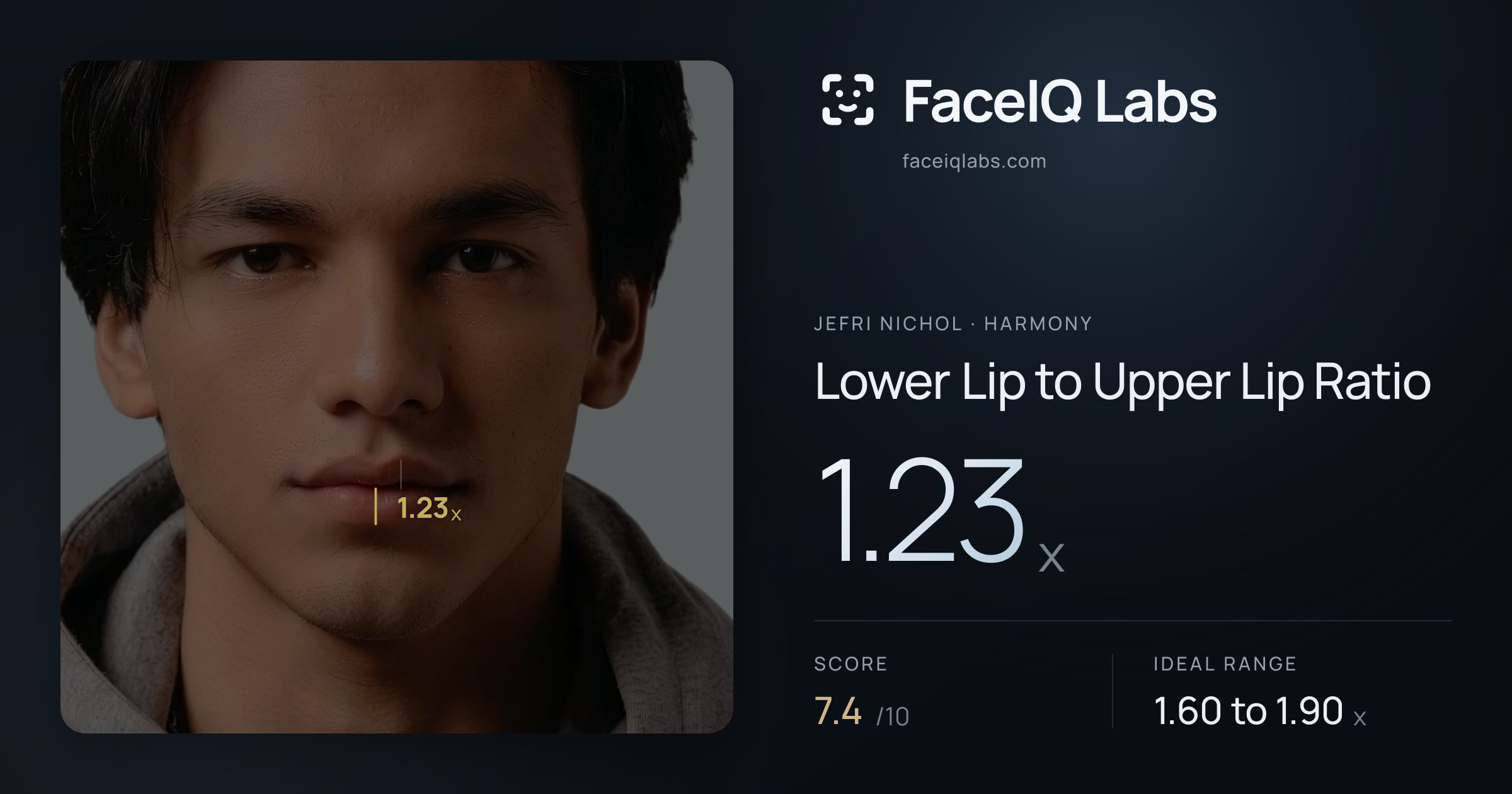 Jefri Nichol Lower Lip to Upper Lip Ratio: 1.23x, drawn on the photo