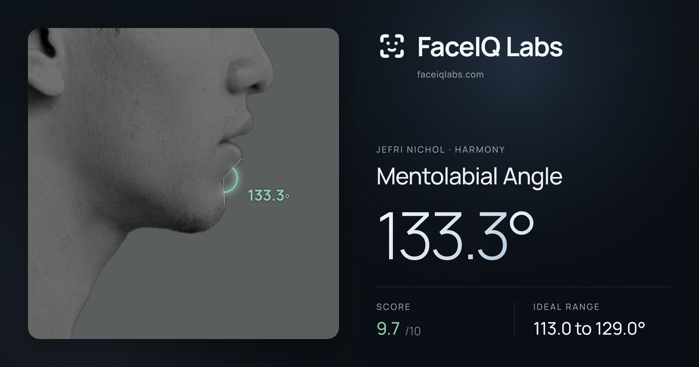 Jefri Nichol Mentolabial Angle: 133.3°, drawn on the photo