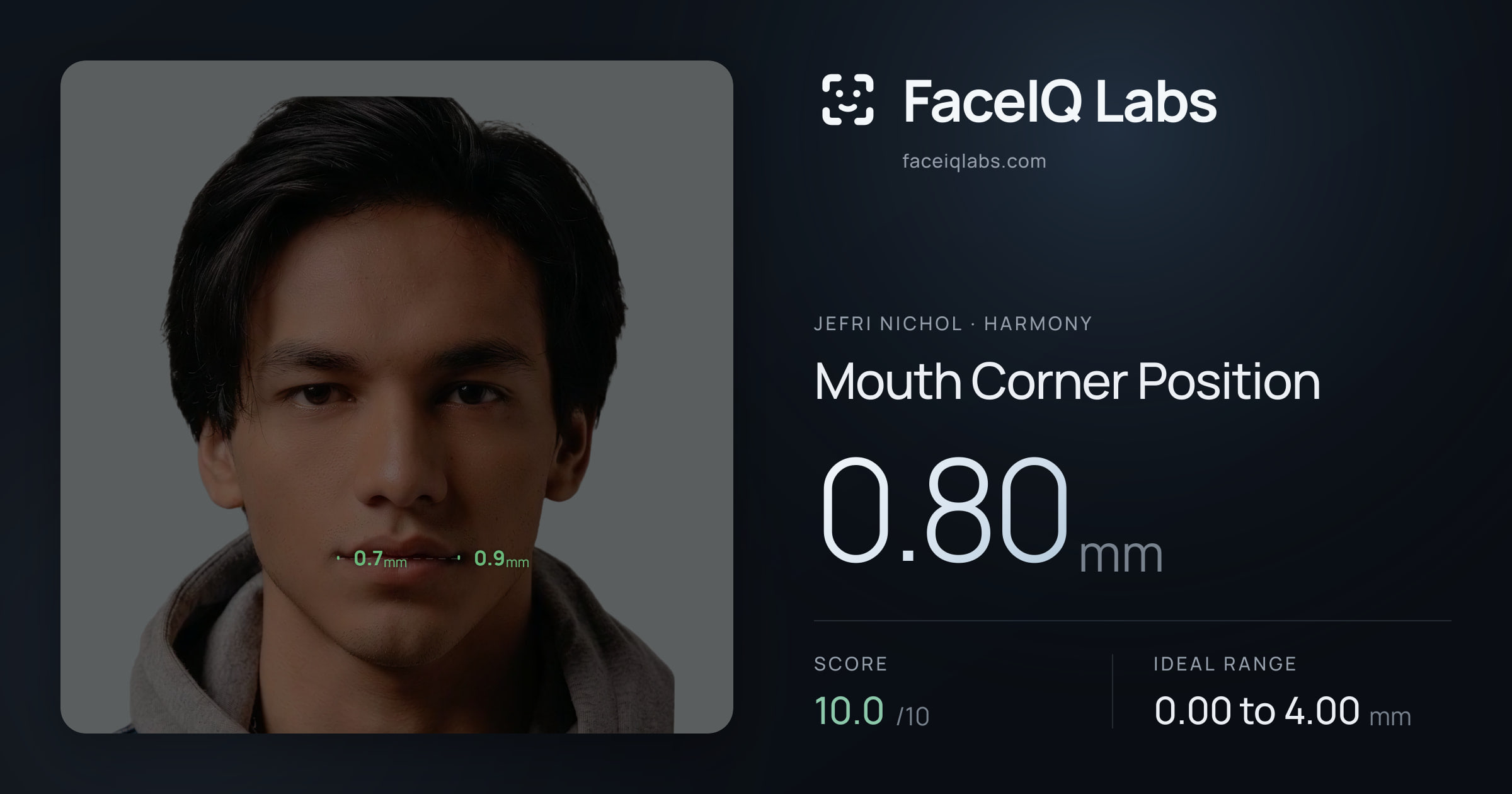 Jefri Nichol Mouth Corner Position: 0.80mm, drawn on the photo