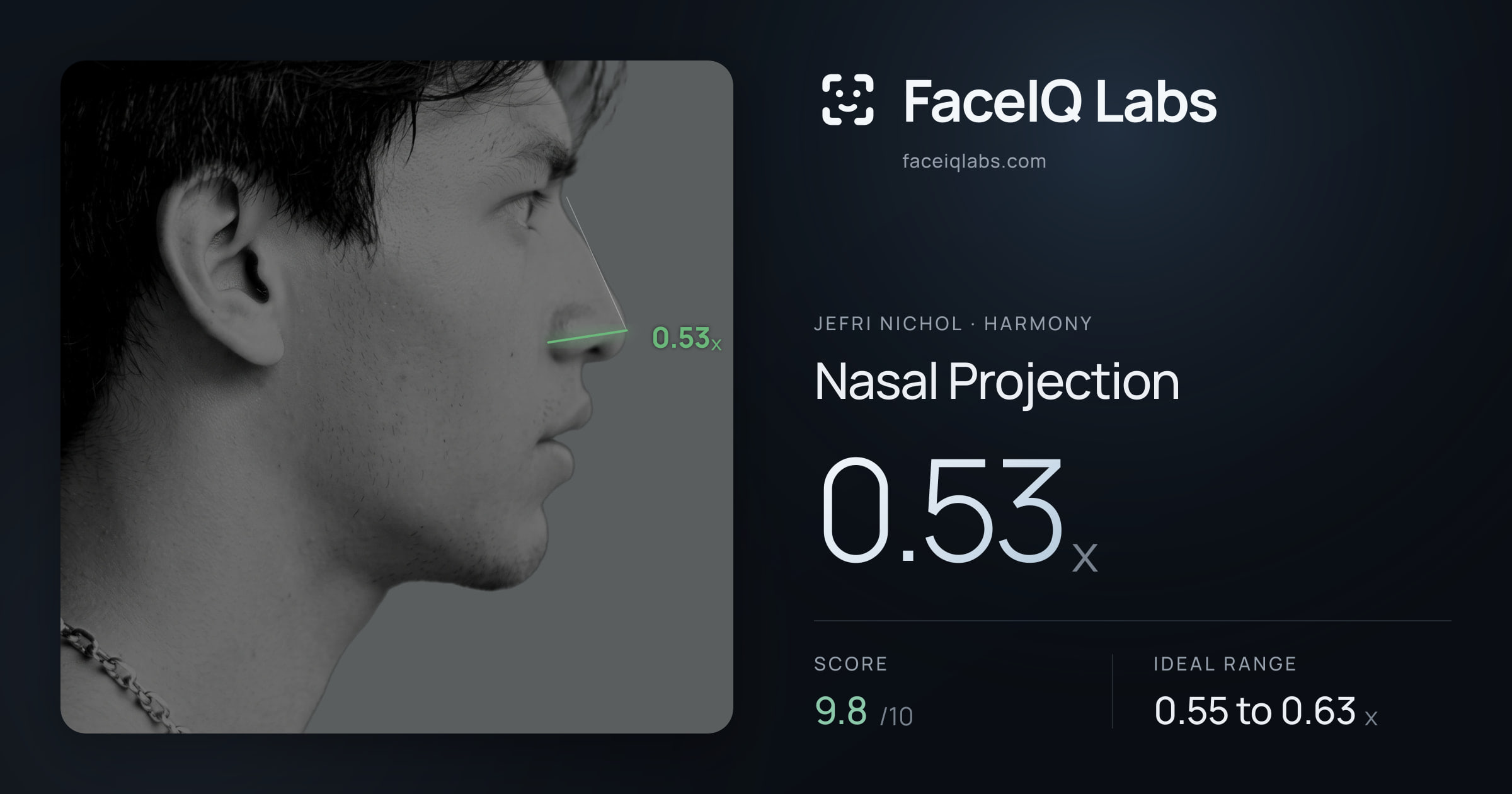 Jefri Nichol Nasal Projection: 0.53x, drawn on the photo