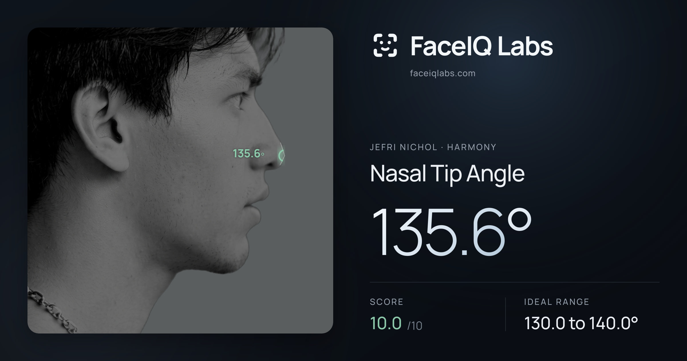 Jefri Nichol Nasal Tip Angle: 135.6°, drawn on the photo
