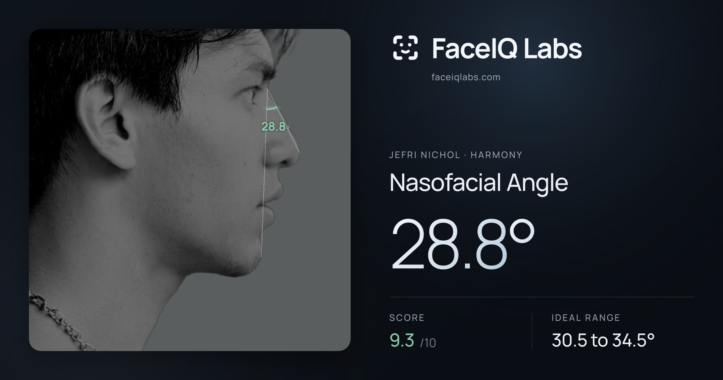 Jefri Nichol Nasofacial Angle: 28.8°, drawn on the photo