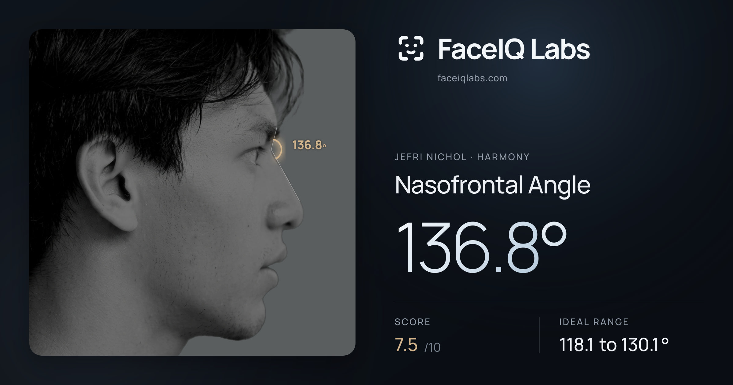 Jefri Nichol Nasofrontal Angle: 136.8°, drawn on the photo