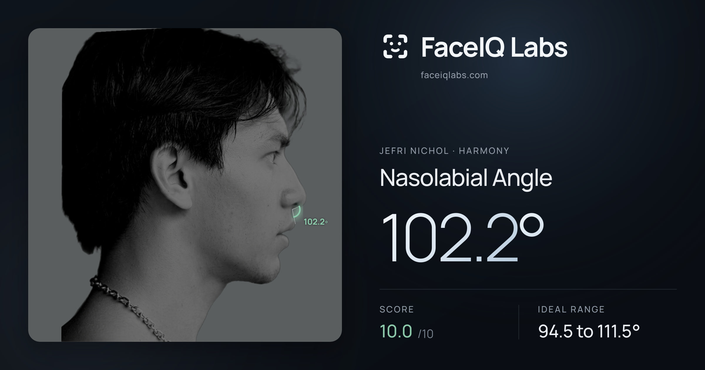 Jefri Nichol Nasolabial Angle: 102.2°, drawn on the photo