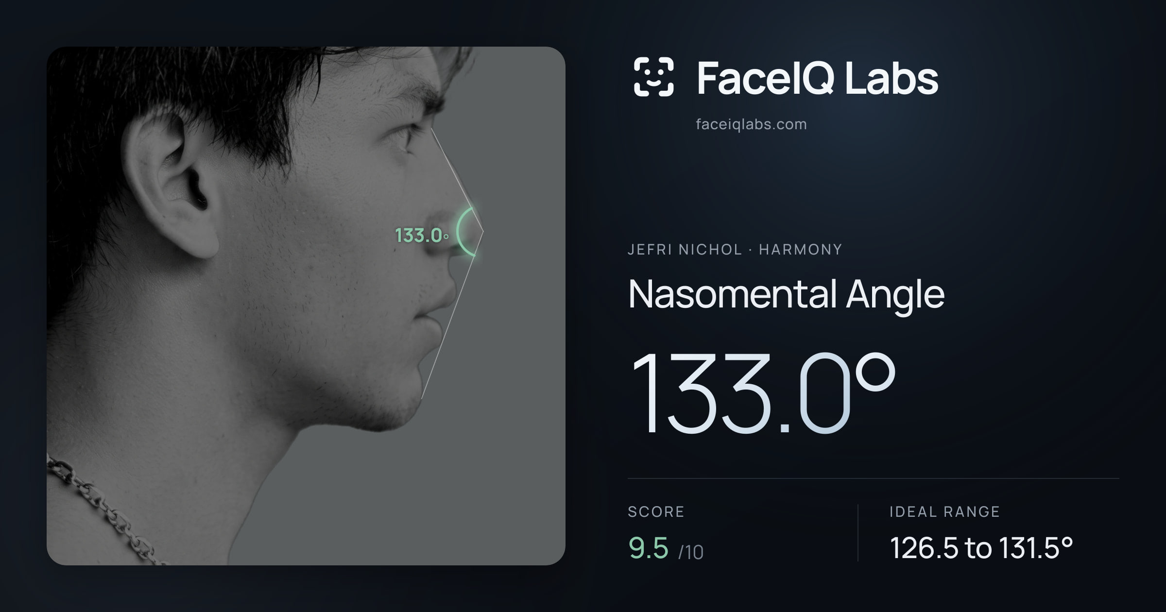 Jefri Nichol Nasomental Angle: 133.0°, drawn on the photo