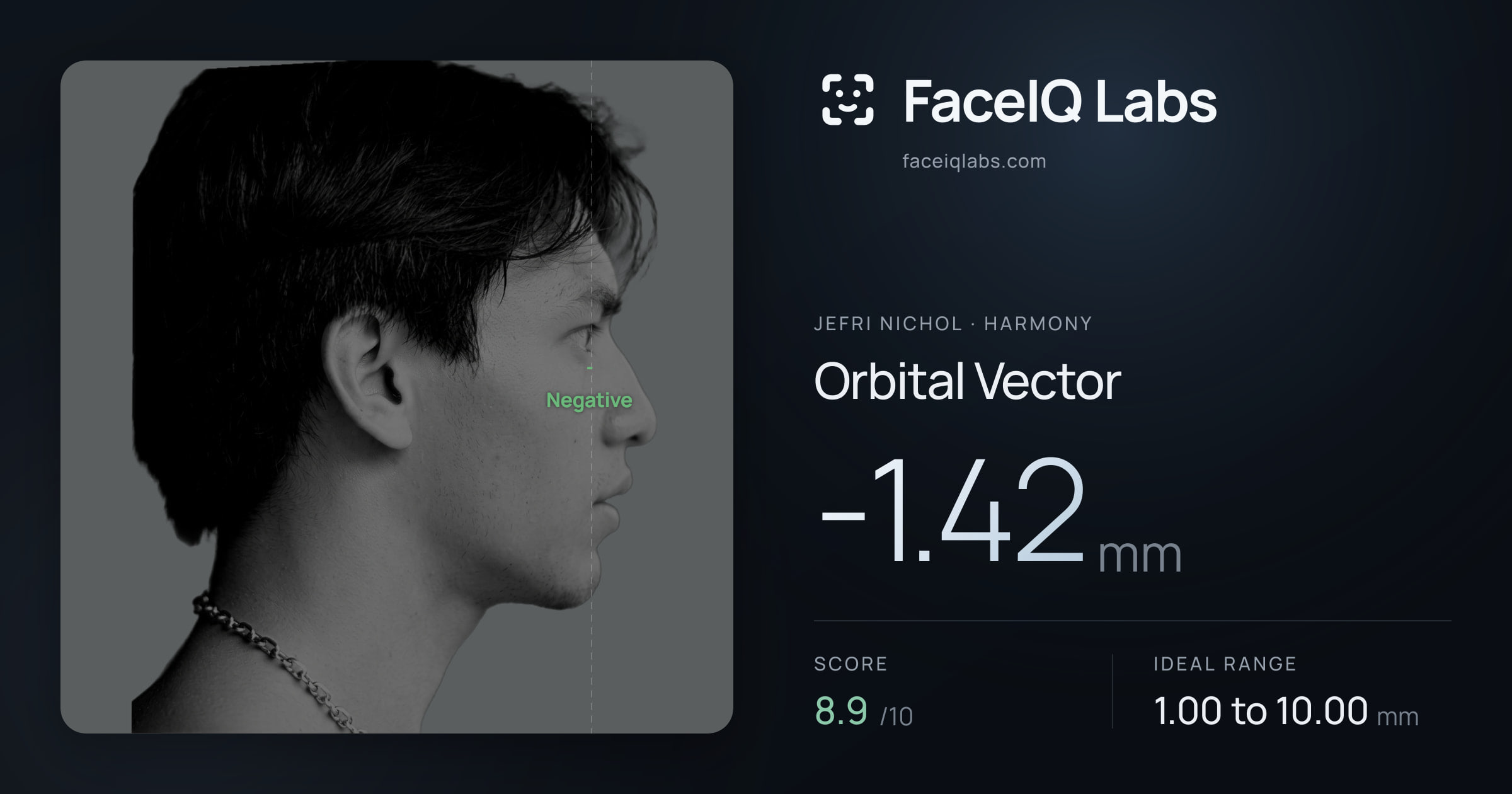 Jefri Nichol Orbital Vector: -1.42mm, drawn on the photo