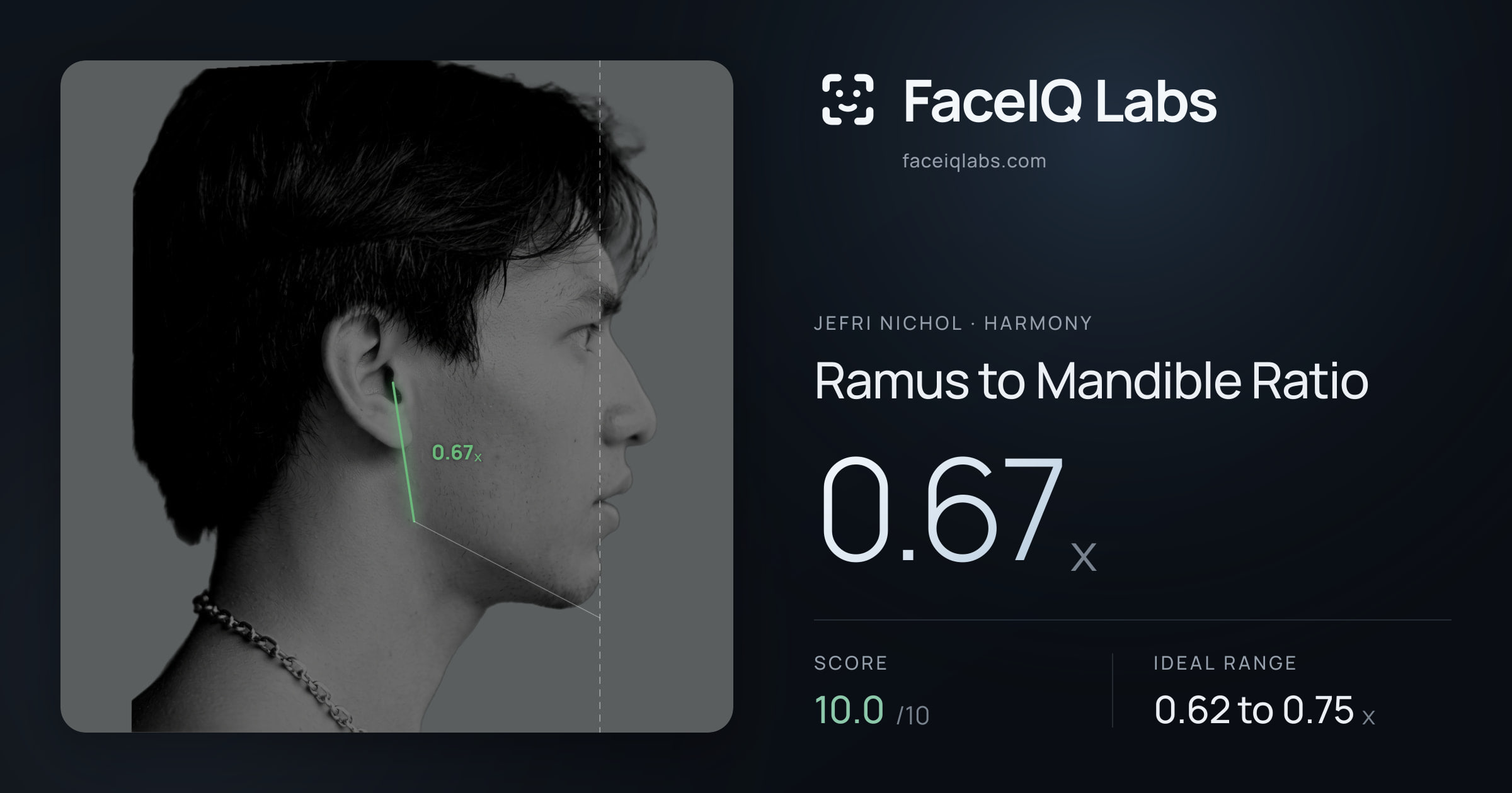 Jefri Nichol Ramus to Mandible Ratio: 0.67x, drawn on the photo
