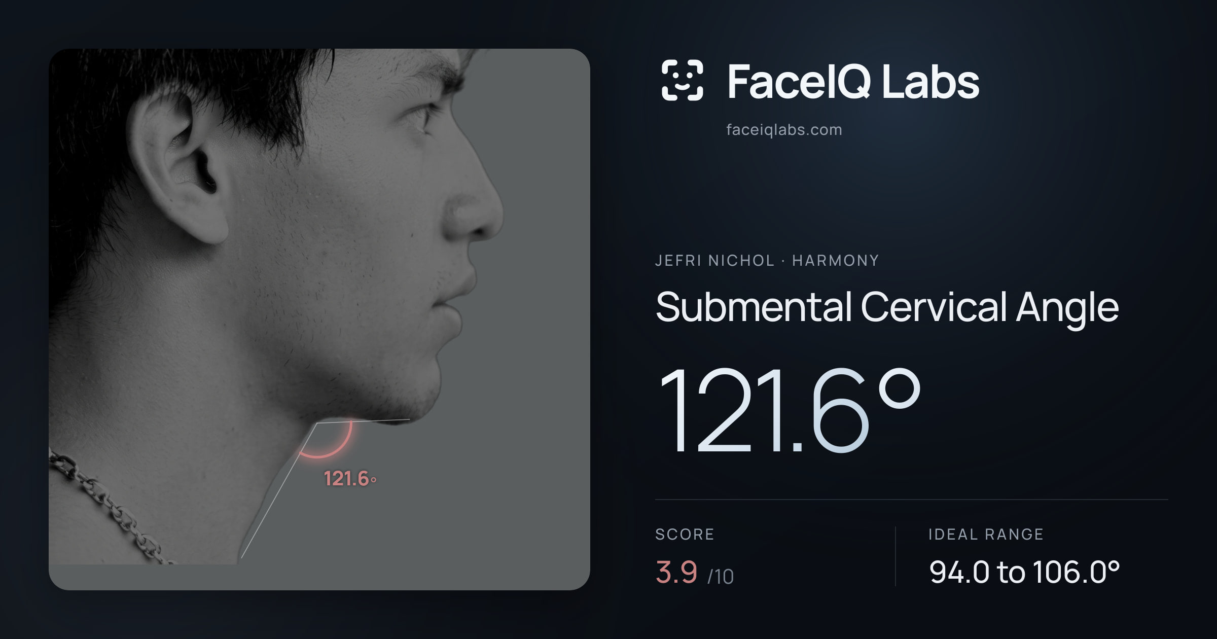 Jefri Nichol Submental Cervical Angle: 121.6°, drawn on the photo