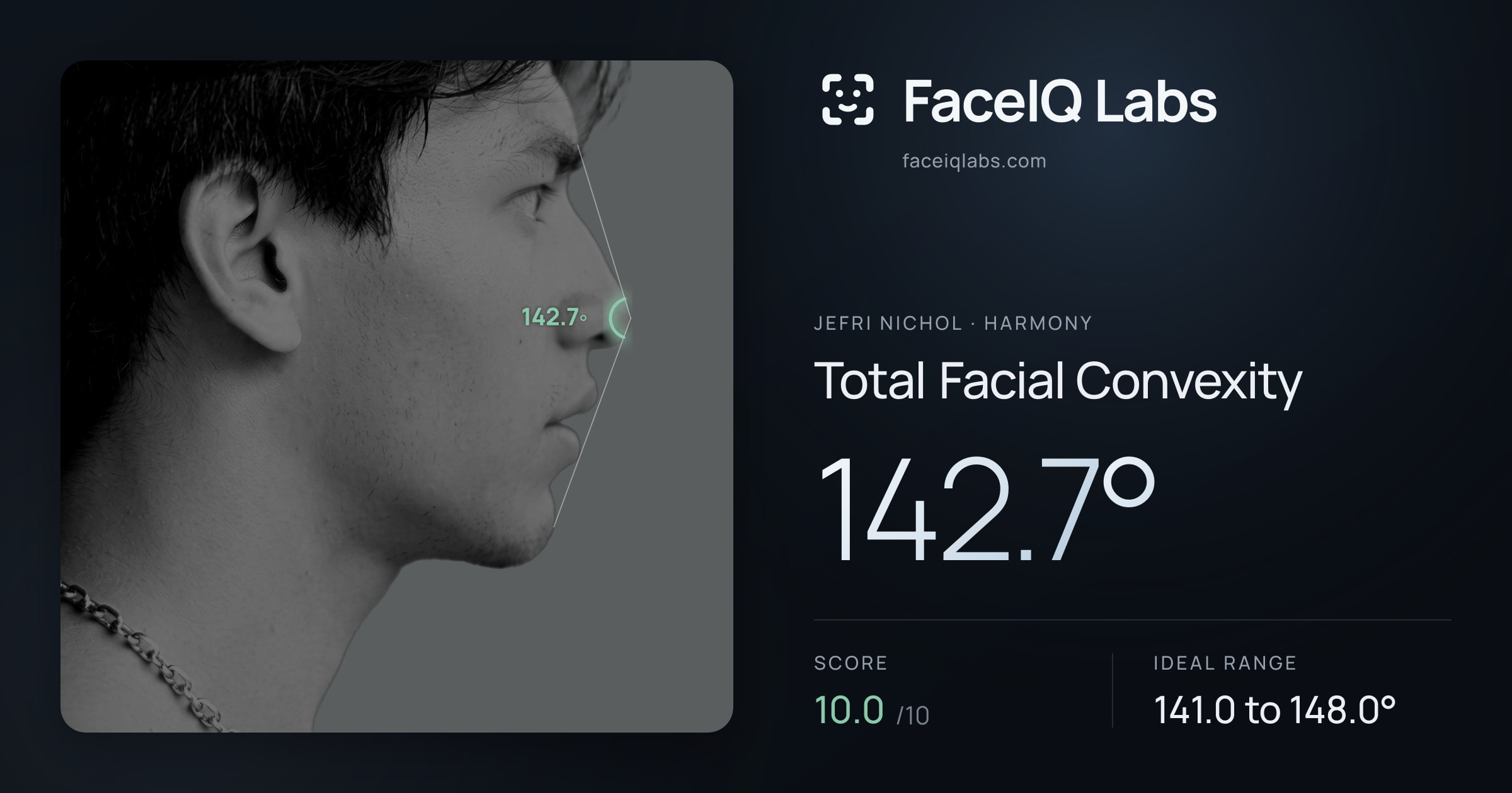 Jefri Nichol Total Facial Convexity: 142.7°, drawn on the photo