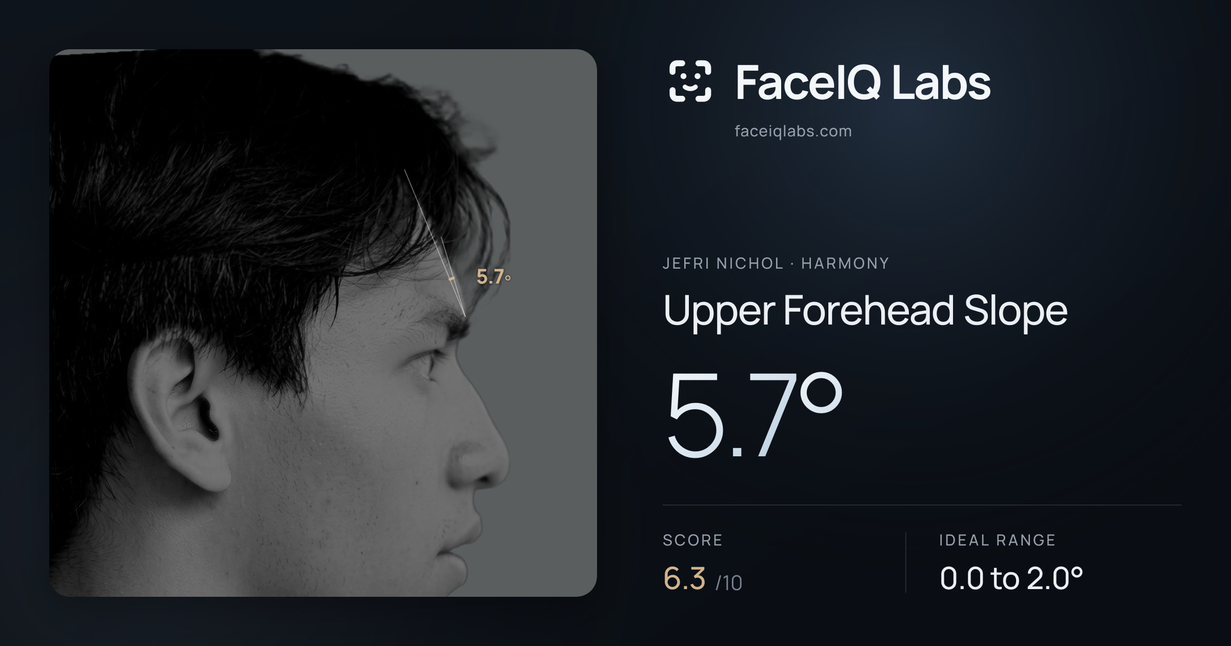 Jefri Nichol Upper Forehead Slope: 5.7°, drawn on the photo