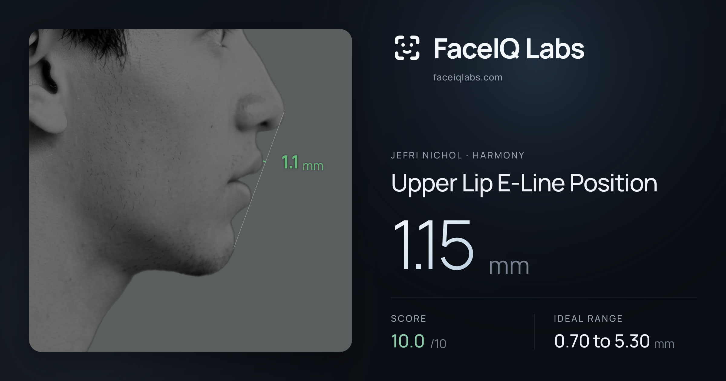 Jefri Nichol Upper Lip E-Line Position: 1.15mm, drawn on the photo