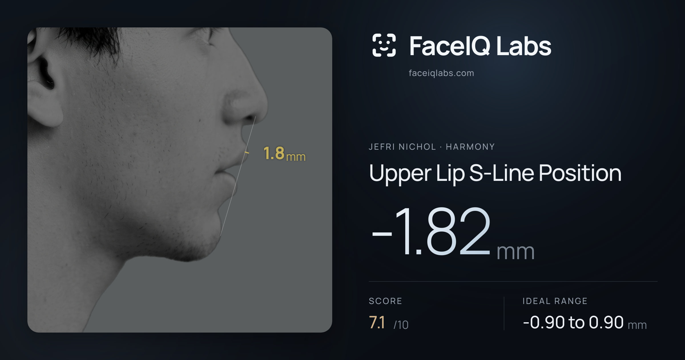 Jefri Nichol Upper Lip S-Line Position: -1.82mm, drawn on the photo