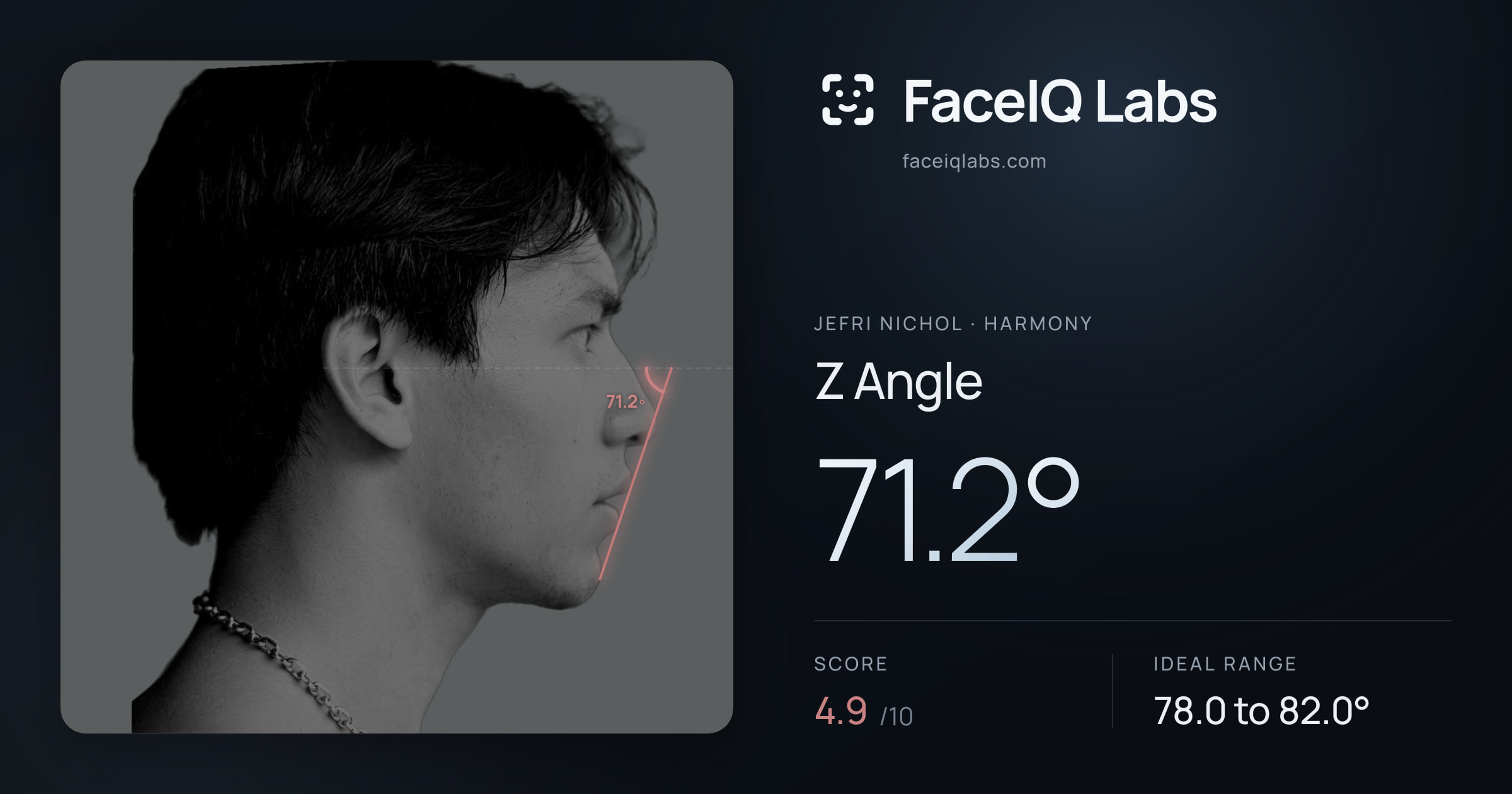 Jefri Nichol Z Angle: 71.2°, drawn on the photo