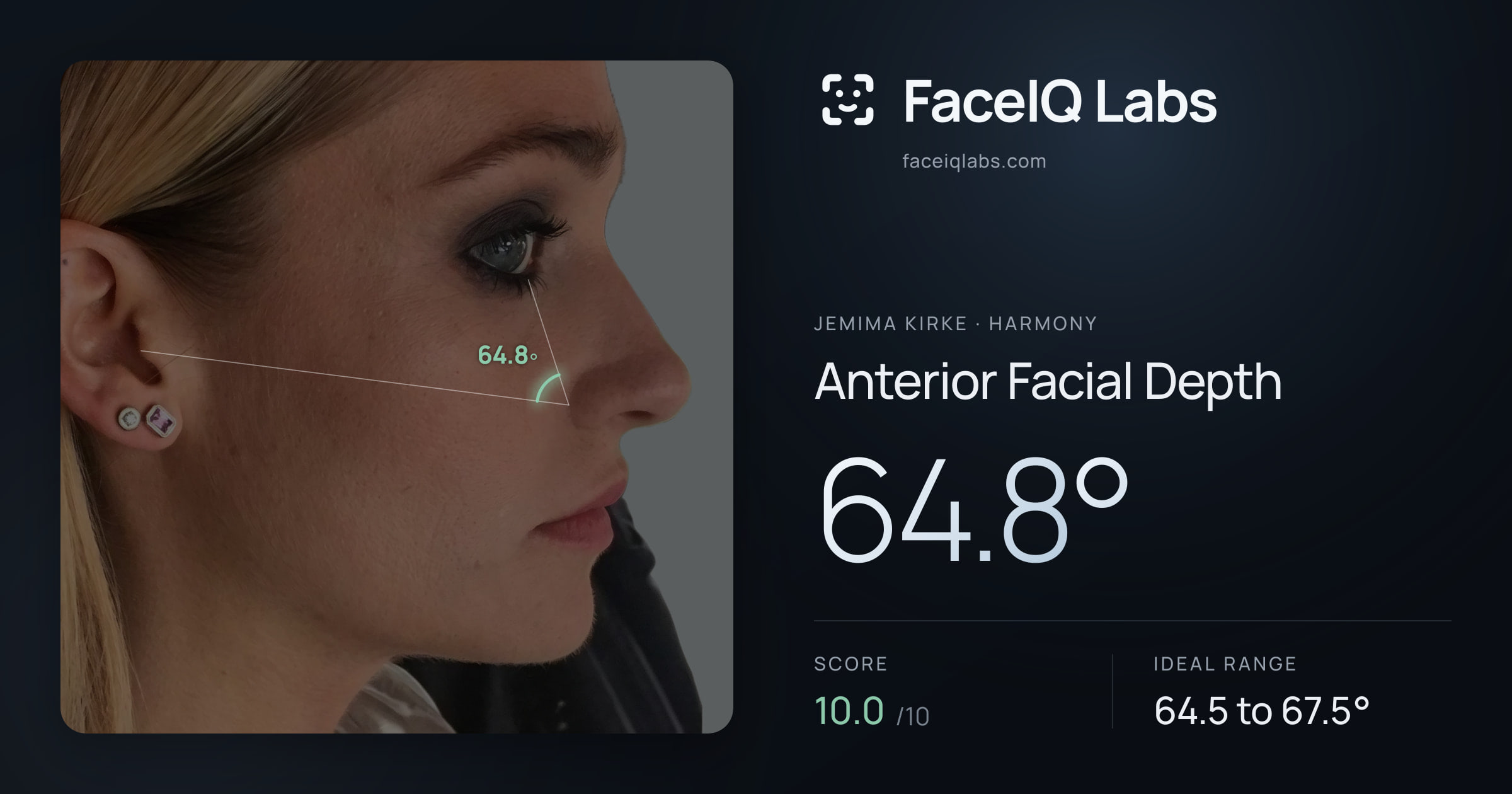 Jemima Kirke Anterior Facial Depth: 64.8°, drawn on the photo