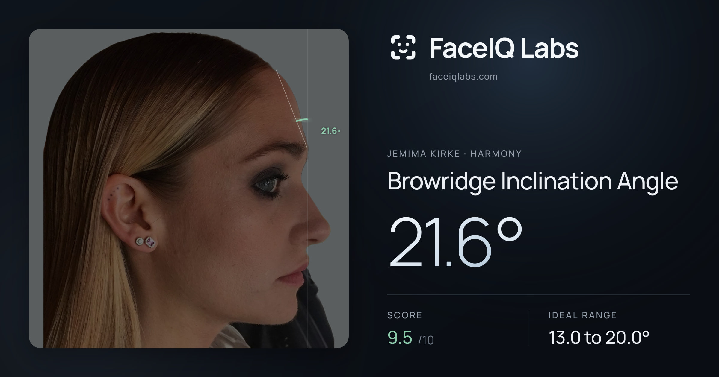 Jemima Kirke Browridge Inclination Angle: 21.6°, drawn on the photo