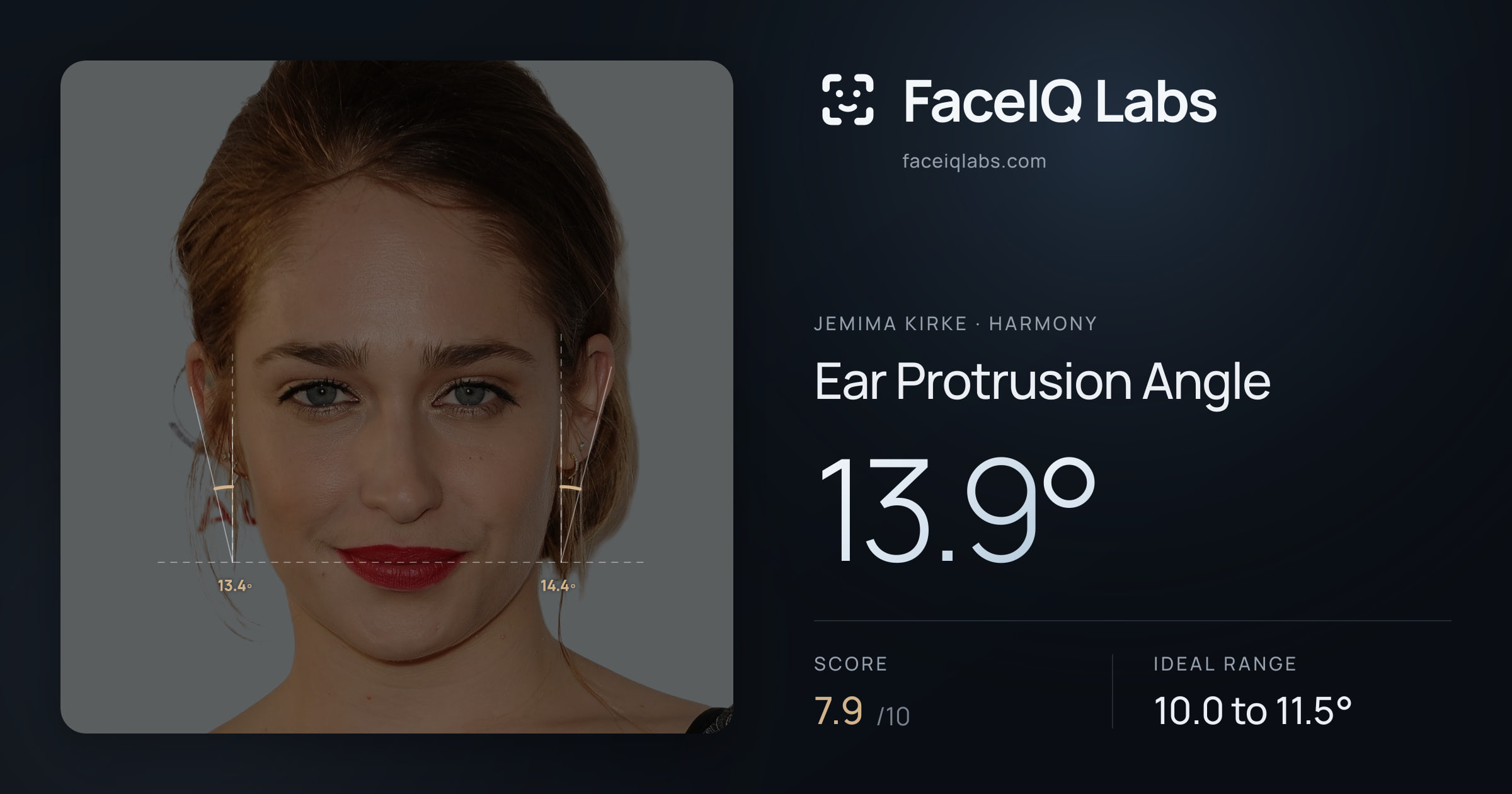 Jemima Kirke Ear Protrusion Angle: 13.9°, drawn on the photo