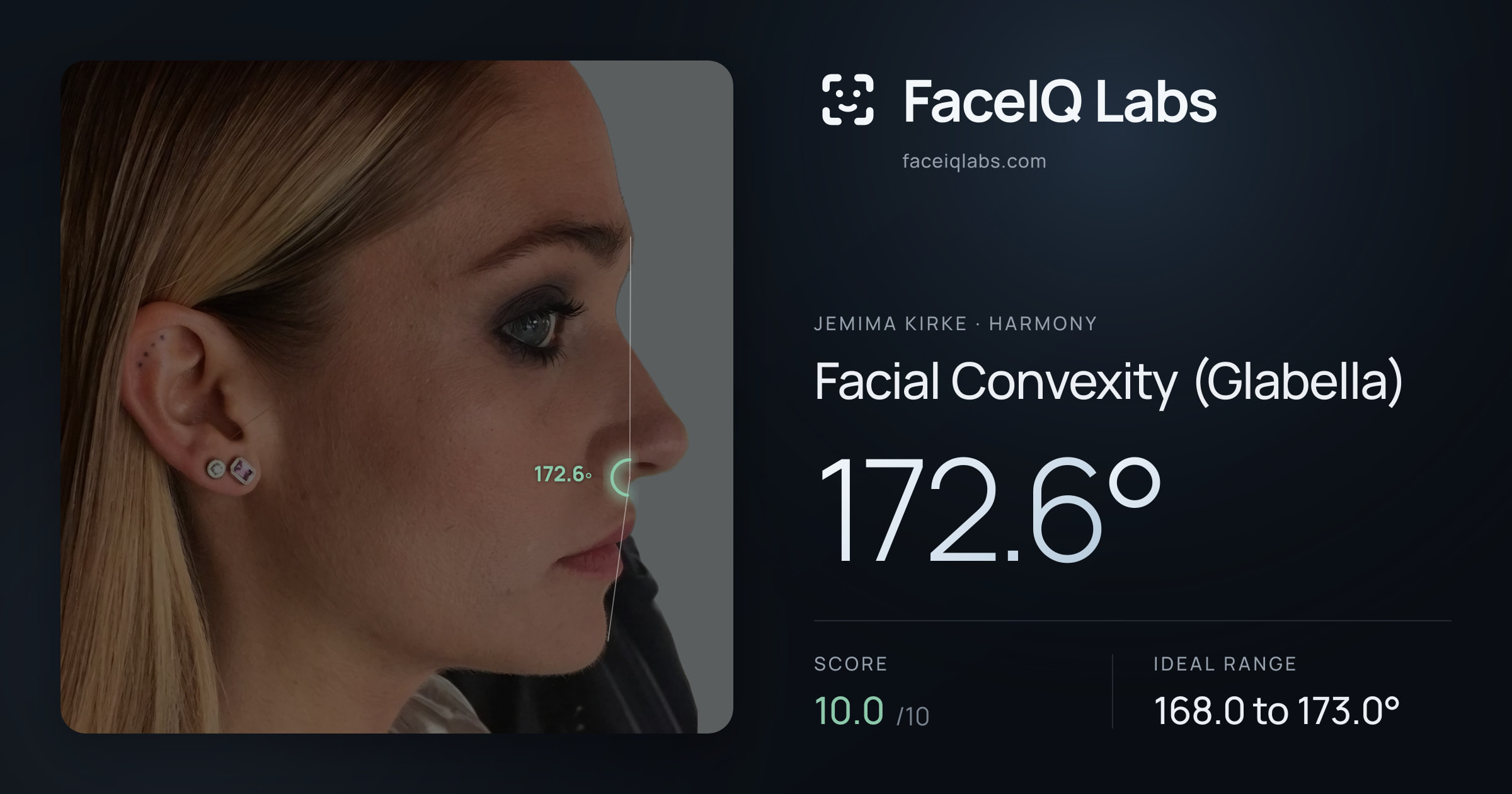 Jemima Kirke Facial Convexity (Glabella): 172.6°, drawn on the photo
