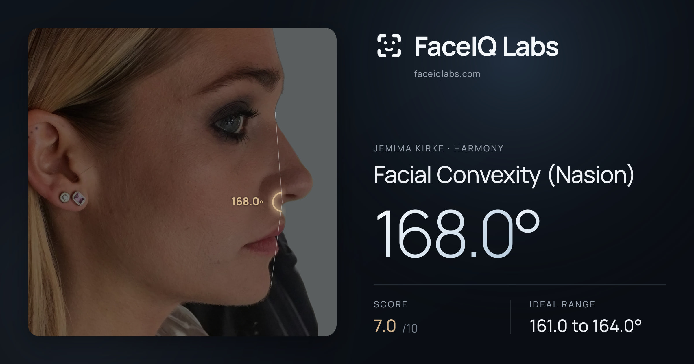 Jemima Kirke Facial Convexity (Nasion): 168.0°, drawn on the photo