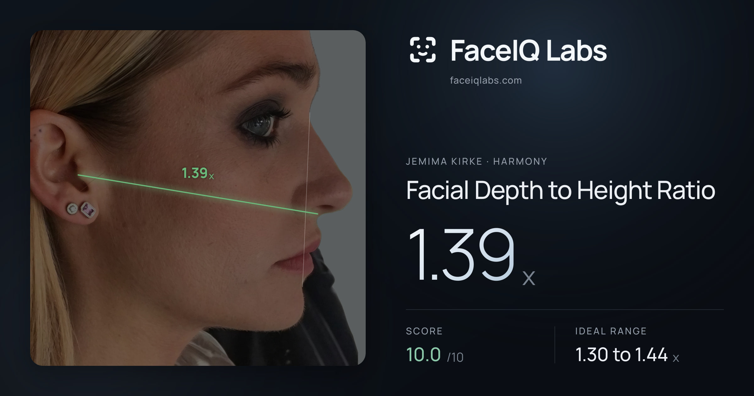 Jemima Kirke Facial Depth to Height Ratio: 1.39x, drawn on the photo