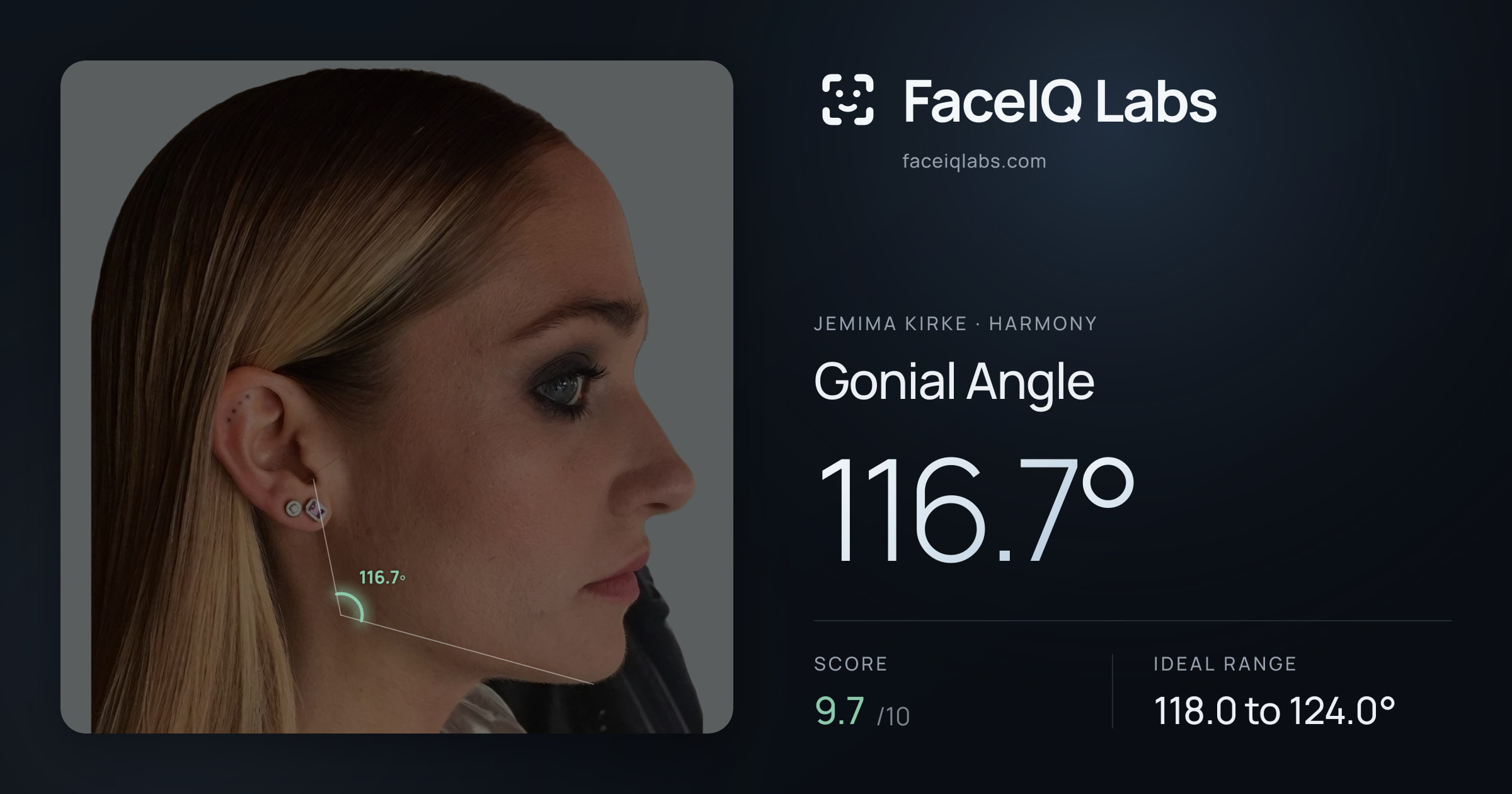 Jemima Kirke Gonial Angle: 116.7°, drawn on the photo