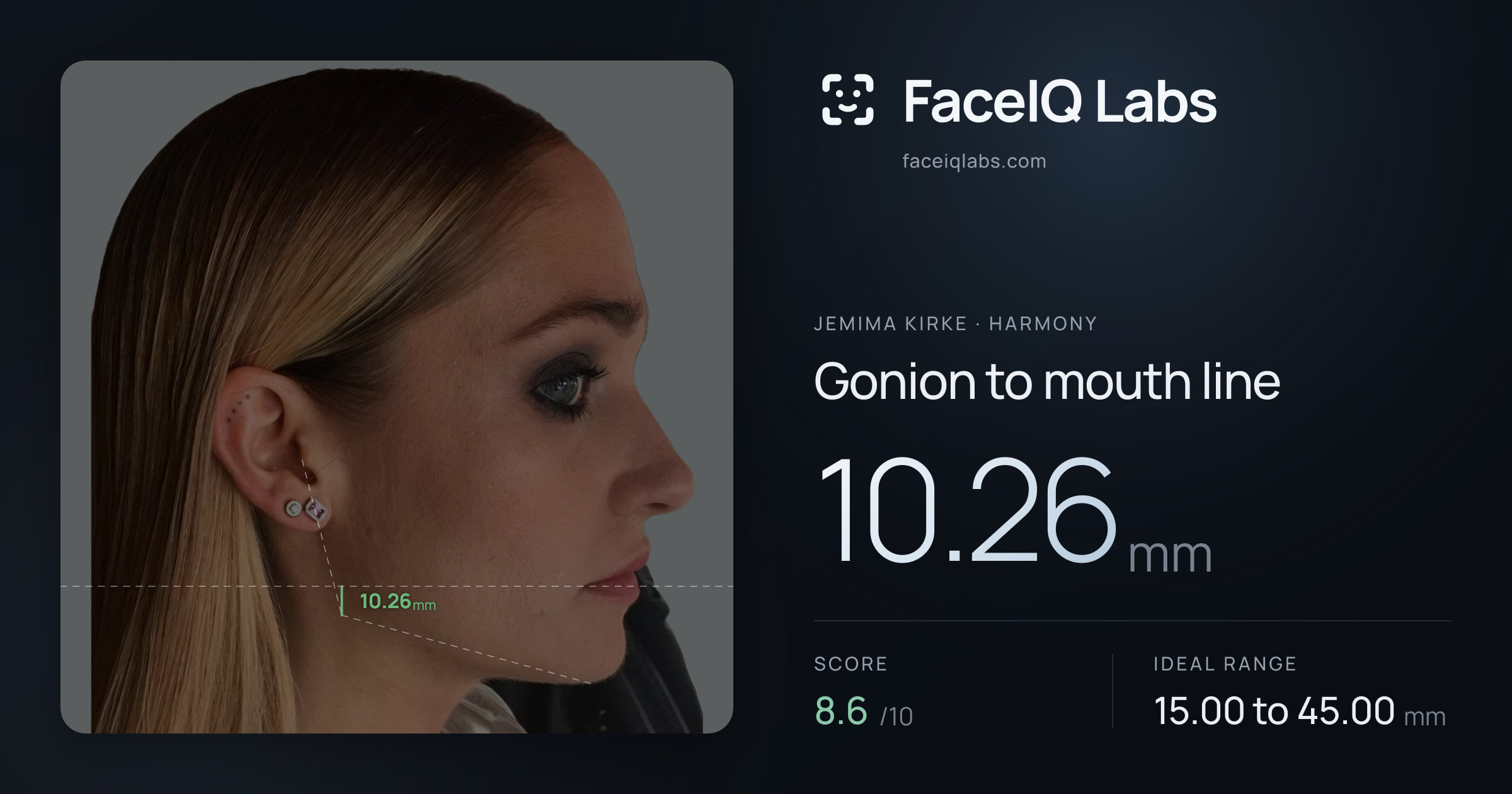 Jemima Kirke Gonion to mouth line: 10.26mm, drawn on the photo